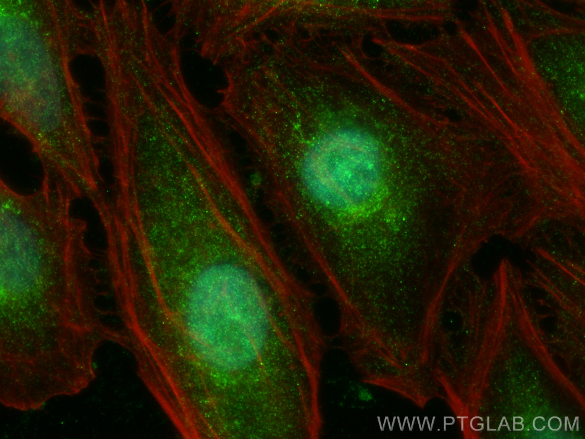 Immunofluorescence (IF) / fluorescent staining of HeLa cells using EYA2 Polyclonal antibody (30607-1-AP)