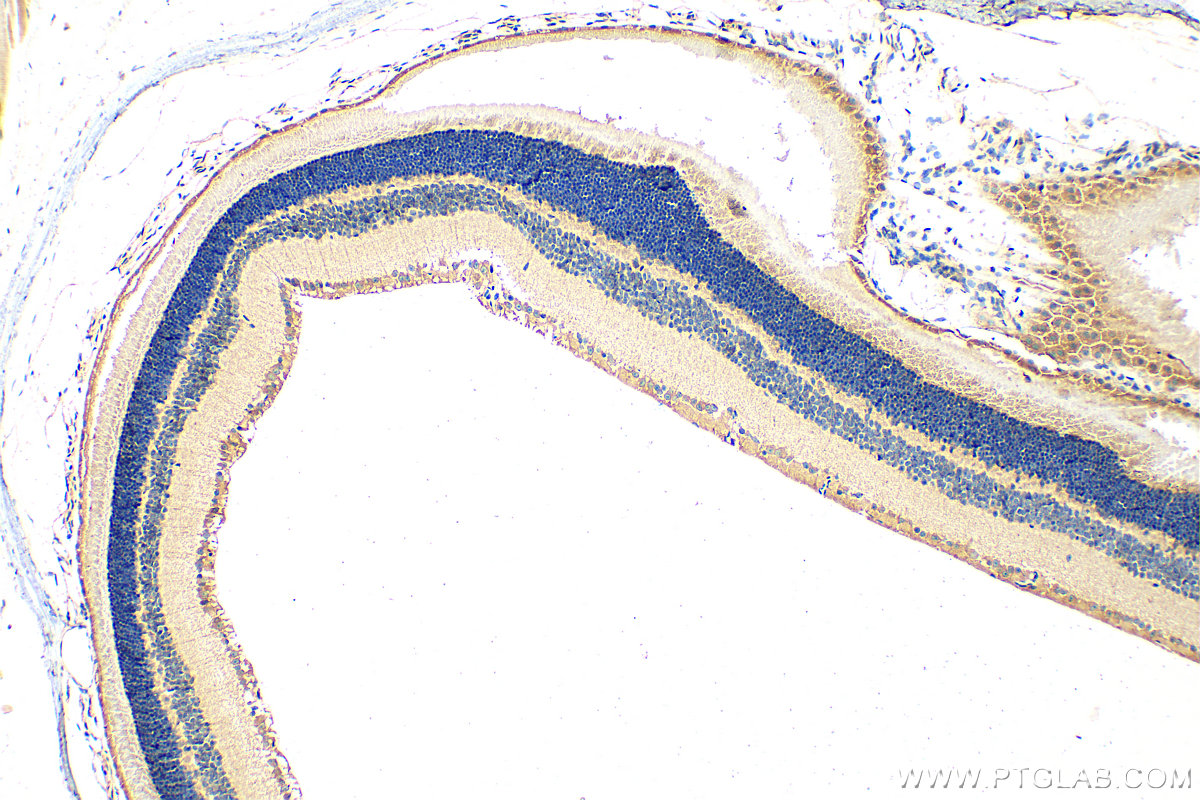 Immunohistochemistry (IHC) staining of mouse eye tissue using EYA2 Polyclonal antibody (30607-1-AP)