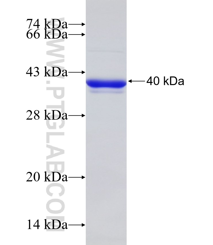 EYA2 fusion protein Ag31827 SDS-PAGE