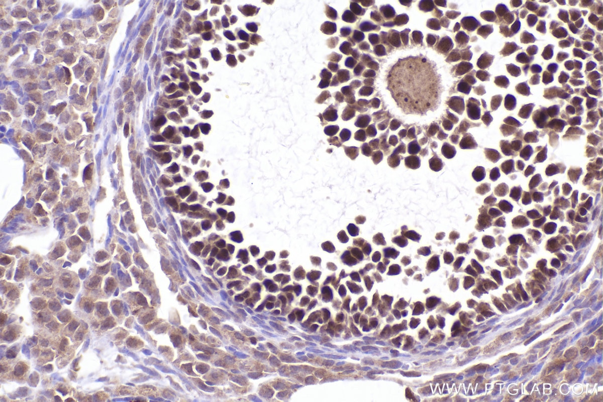 Immunohistochemistry (IHC) staining of mouse ovary tissue using EZH2 Polyclonal antibody (21800-1-AP)