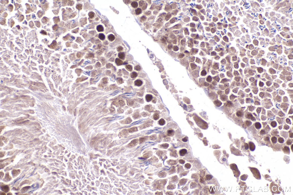 Immunohistochemistry (IHC) staining of rat testis tissue using EZH2 Polyclonal antibody (21800-1-AP)