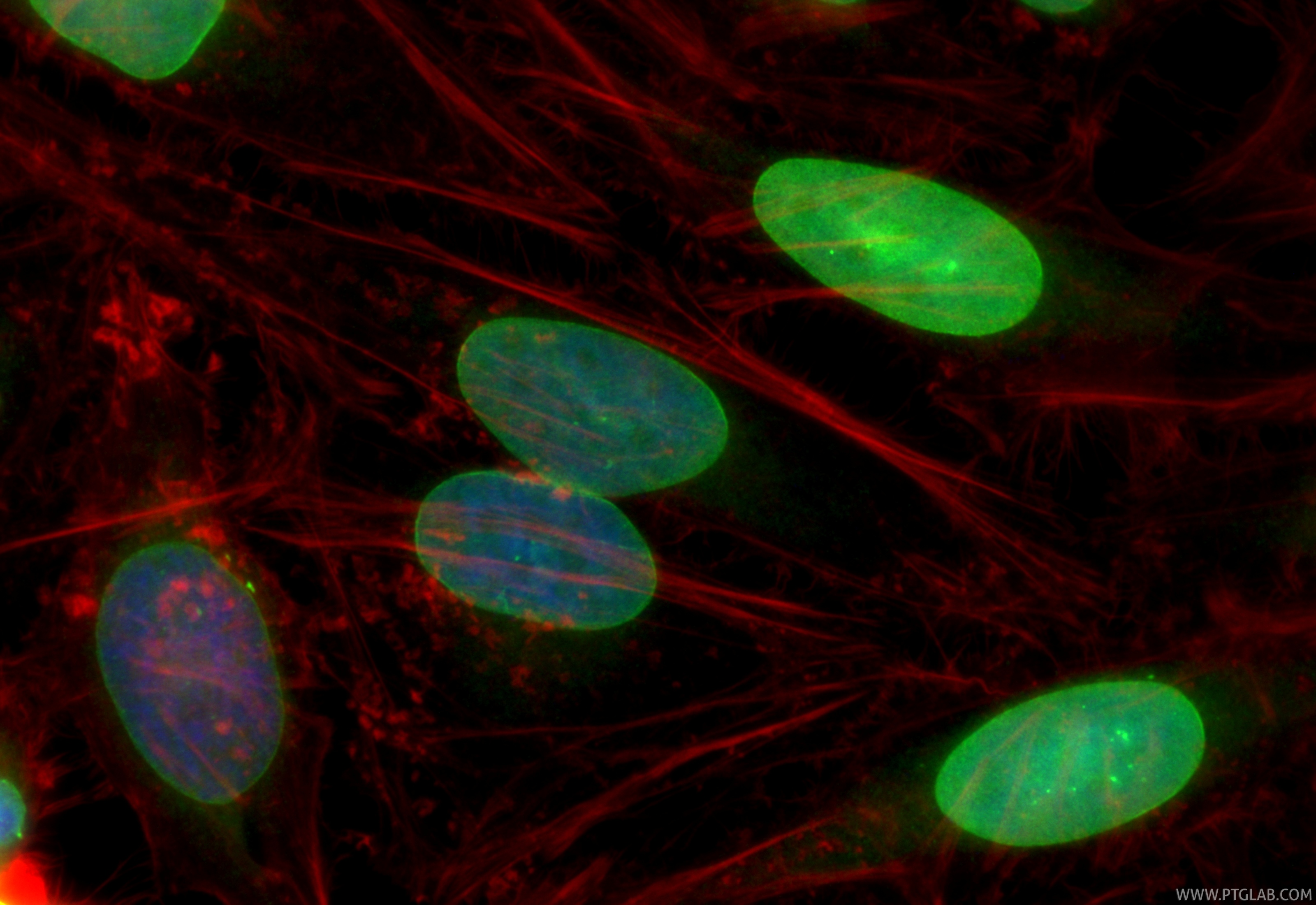 Immunofluorescence (IF) / fluorescent staining of HeLa cells using CoraLite® Plus 488-conjugated Emerin Recombinant m (CL488-82888)