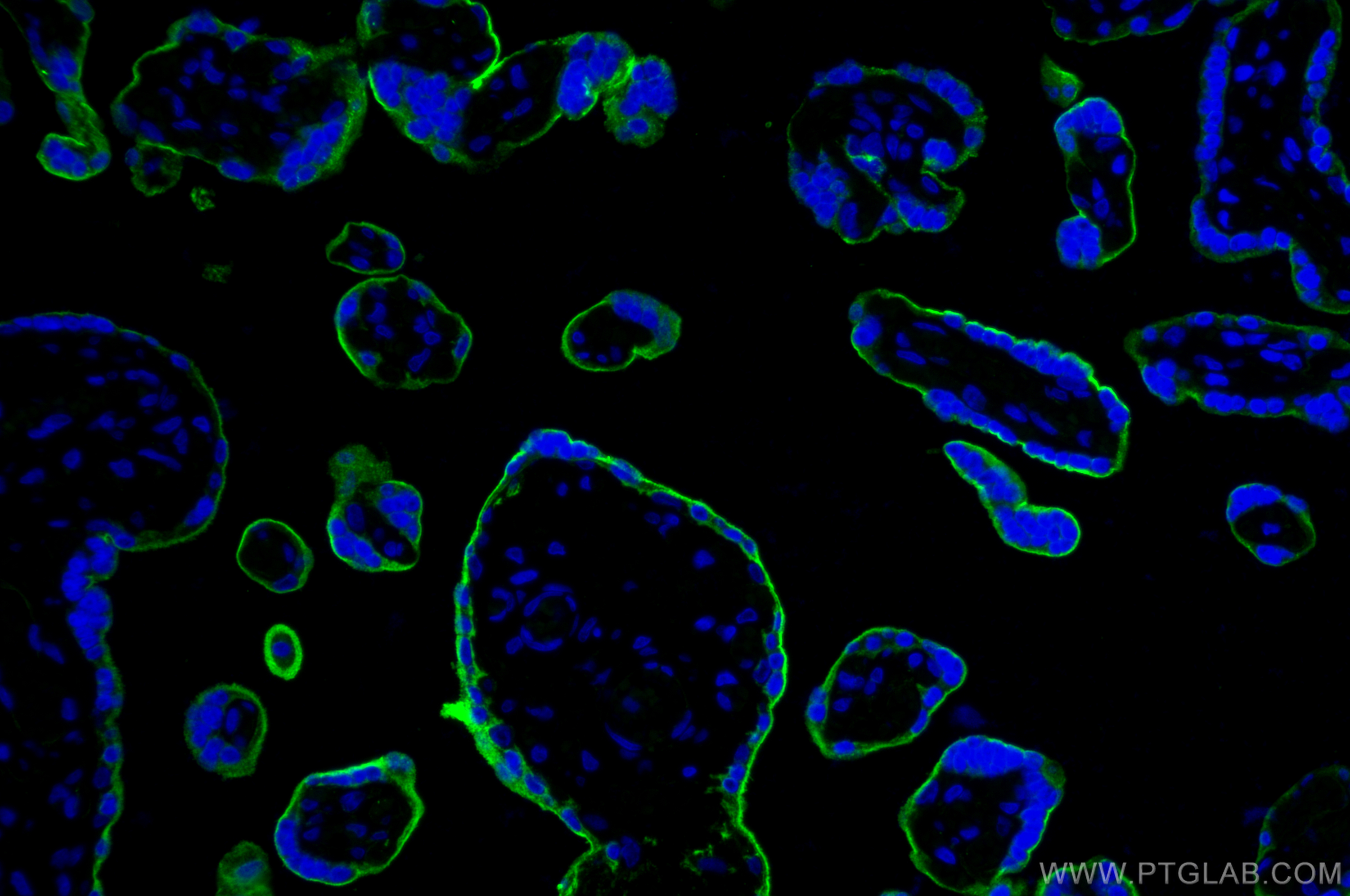 Immunofluorescence (IF) / fluorescent staining of human placenta tissue using Endoglin/CD105 Polyclonal antibody (30730-1-AP)