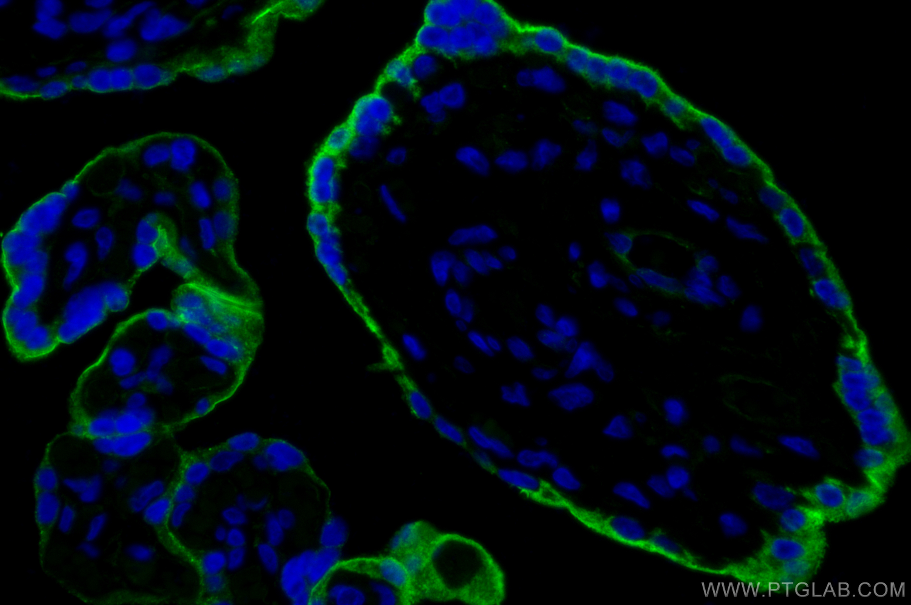 Immunofluorescence (IF) / fluorescent staining of human placenta tissue using Endoglin/CD105 Polyclonal antibody (30730-1-AP)