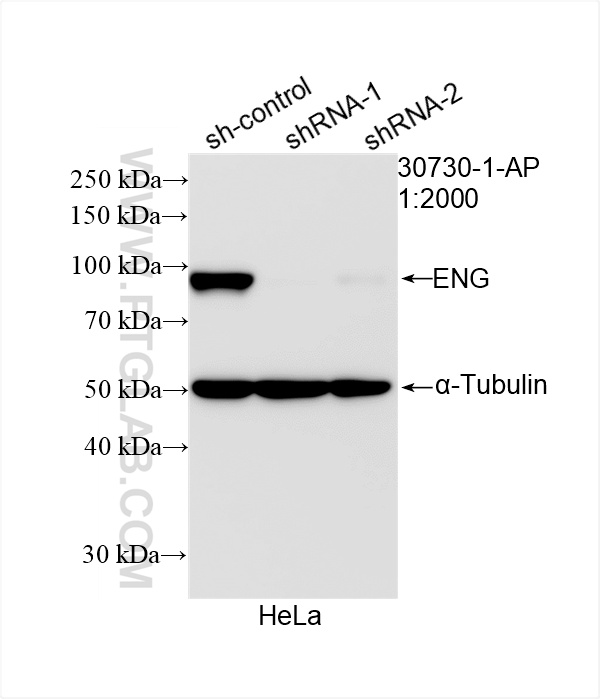 Western Blot (WB) analysis of HeLa cells using Endoglin/CD105 Polyclonal antibody (30730-1-AP)