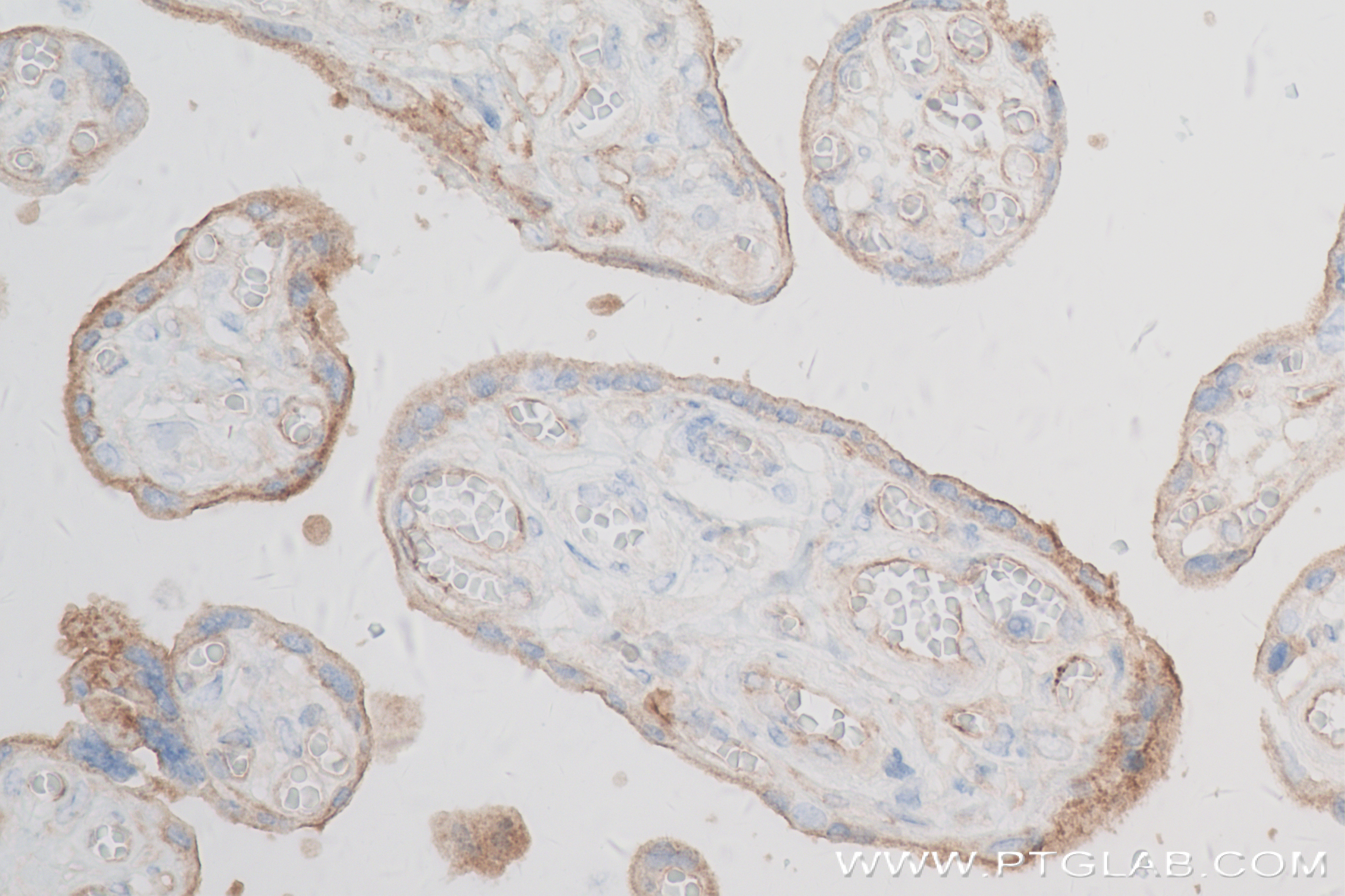 Immunohistochemistry (IHC) staining of human placenta tissue using Endoglin/CD105 Recombinant antibody (82993-6-RR)