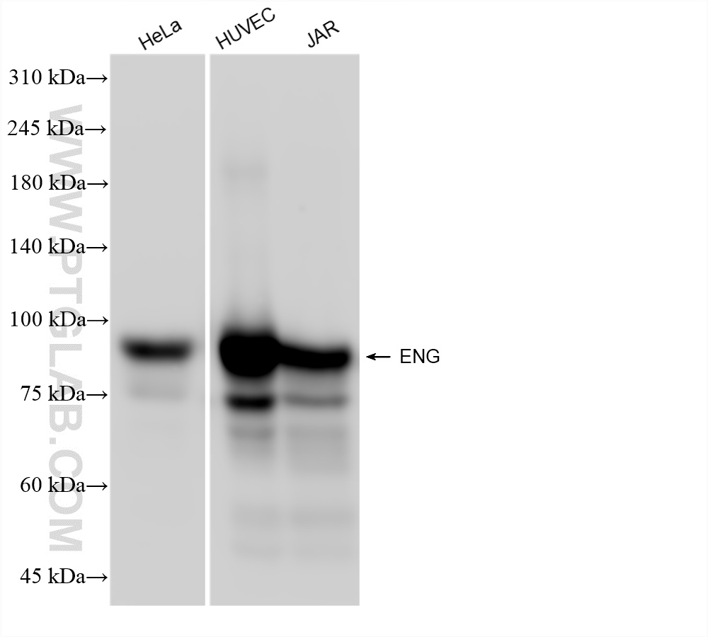 Western Blot (WB) analysis of various lysates using Endoglin/CD105 Recombinant antibody (82993-6-RR)