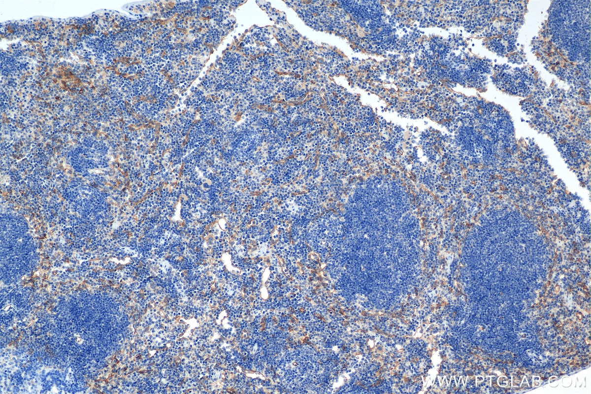 Immunohistochemistry (IHC) staining of mouse spleen tissue using Endoglin/CD105 Recombinant monoclonal antibody (84807-5-RR)