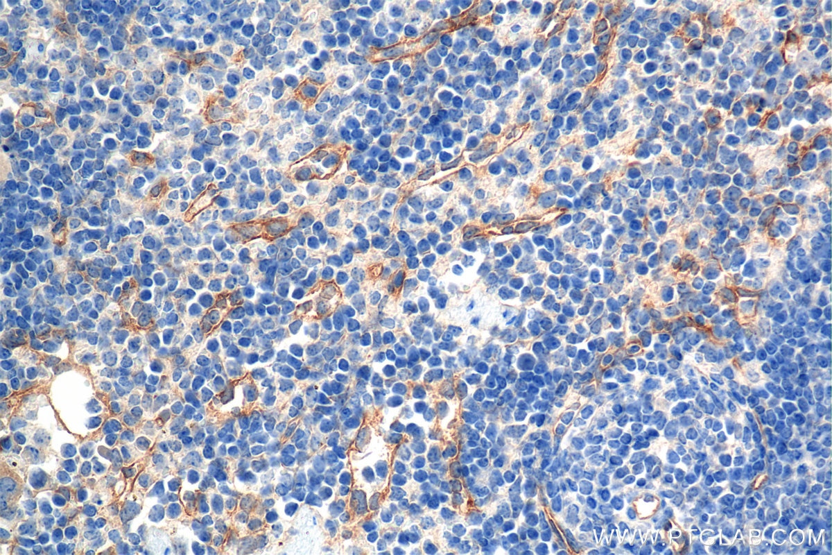 Immunohistochemistry (IHC) staining of mouse spleen tissue using Endoglin/CD105 Recombinant monoclonal antibody (84807-5-RR)