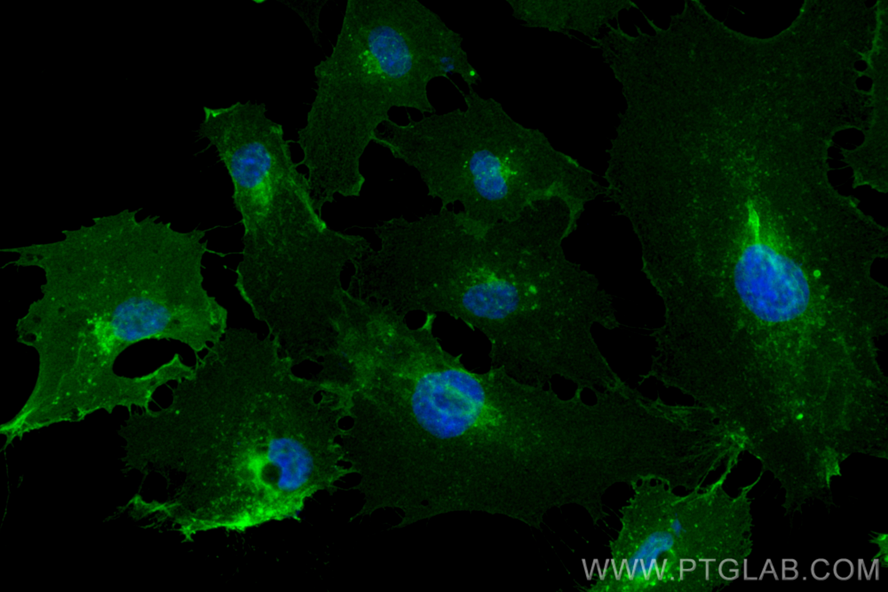 Endoglin/CD105