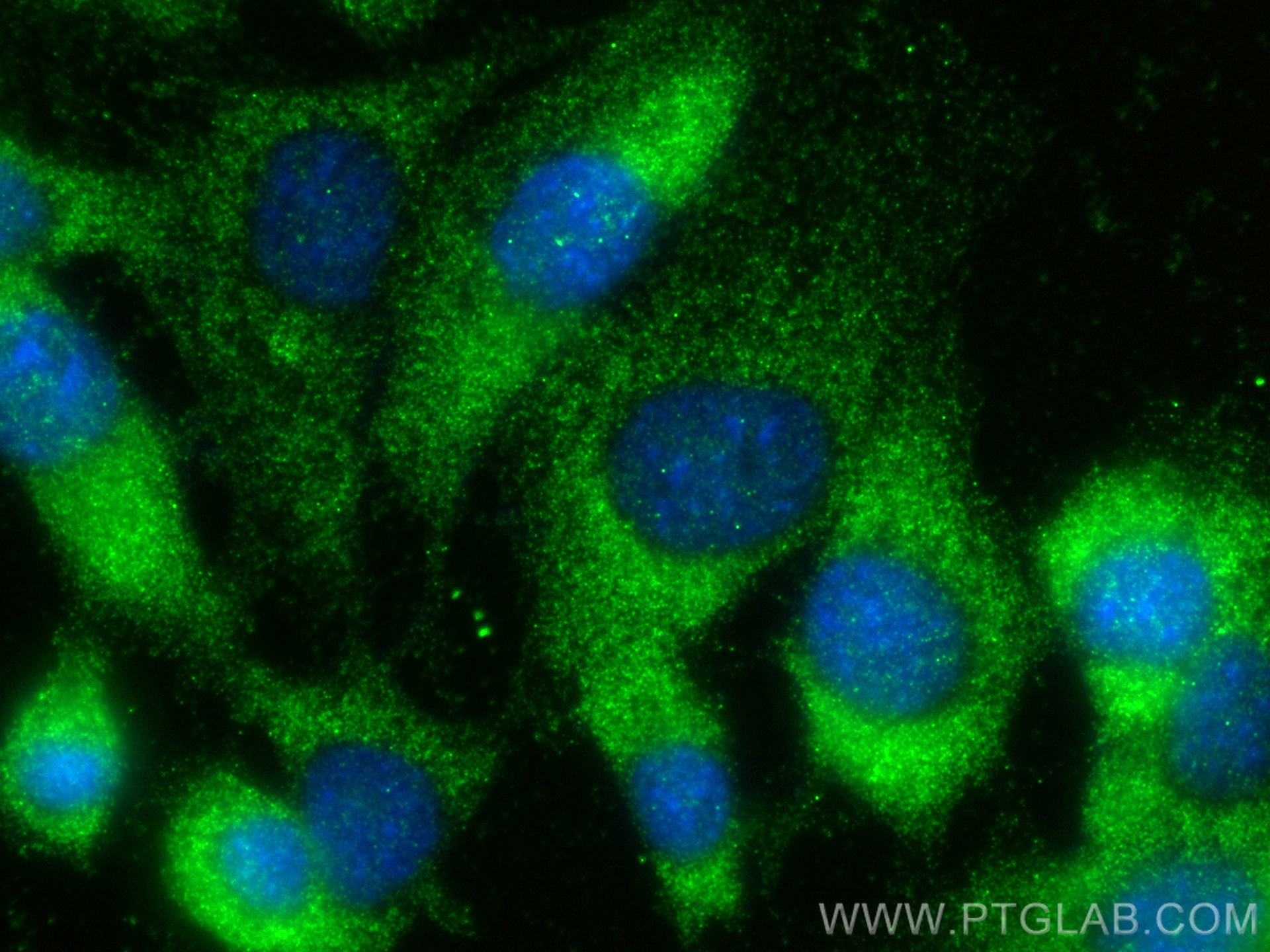 Immunofluorescence (IF) / fluorescent staining of NIH/3T3 cells using Endothelin 3 Polyclonal antibody (27871-1-AP)