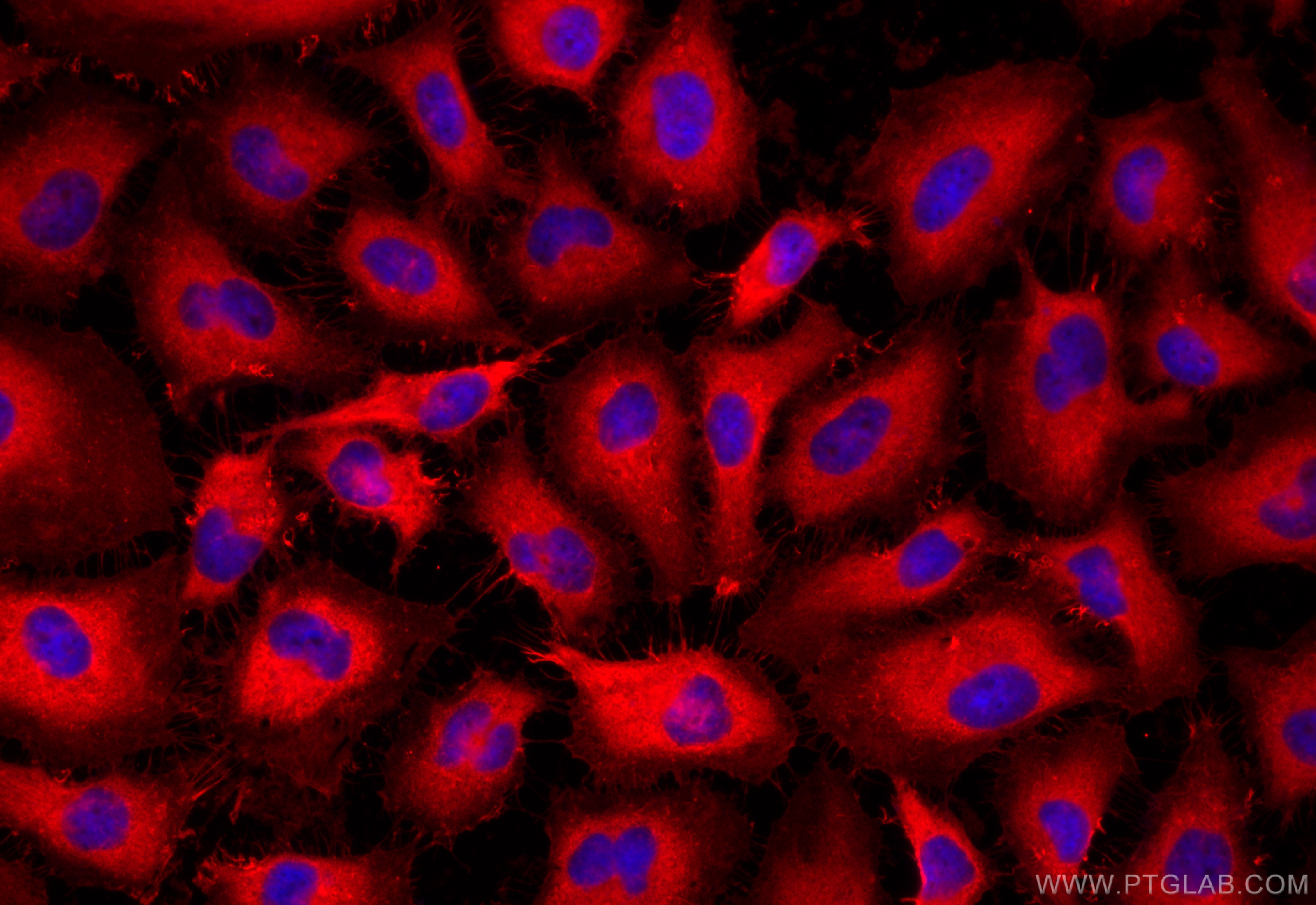 Immunofluorescence (IF) / fluorescent staining of HeLa cells using Ezrin Polyclonal antibody (26056-1-AP)