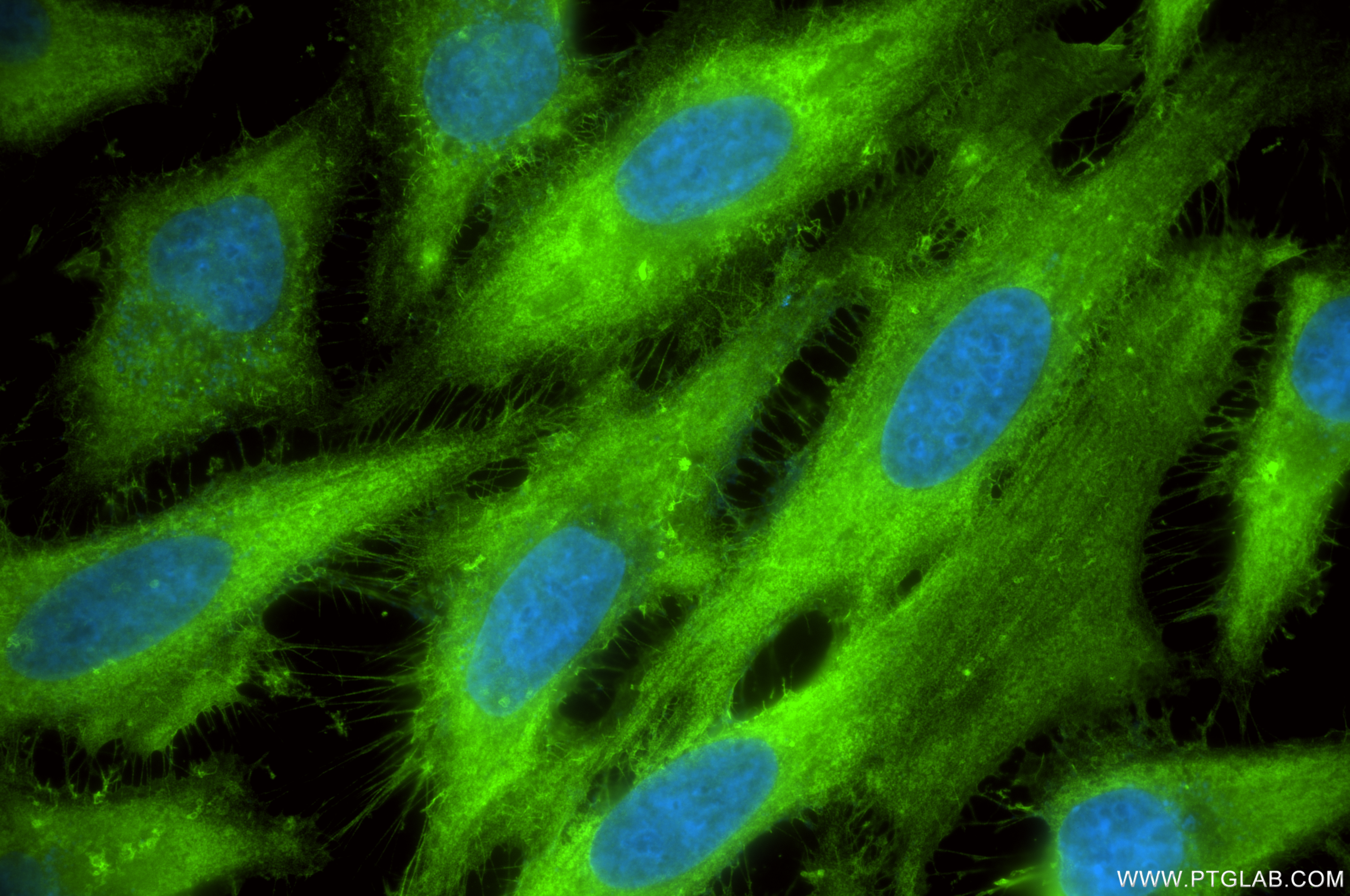 Immunofluorescence (IF) / fluorescent staining of HeLa cells using Ezrin Recombinant antibody (85790-4-RR)