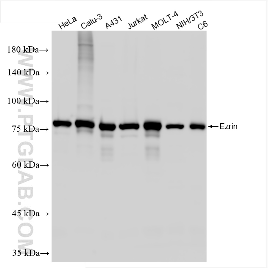 Western Blot (WB) analysis of various lysates using Ezrin Recombinant antibody (85790-4-RR)