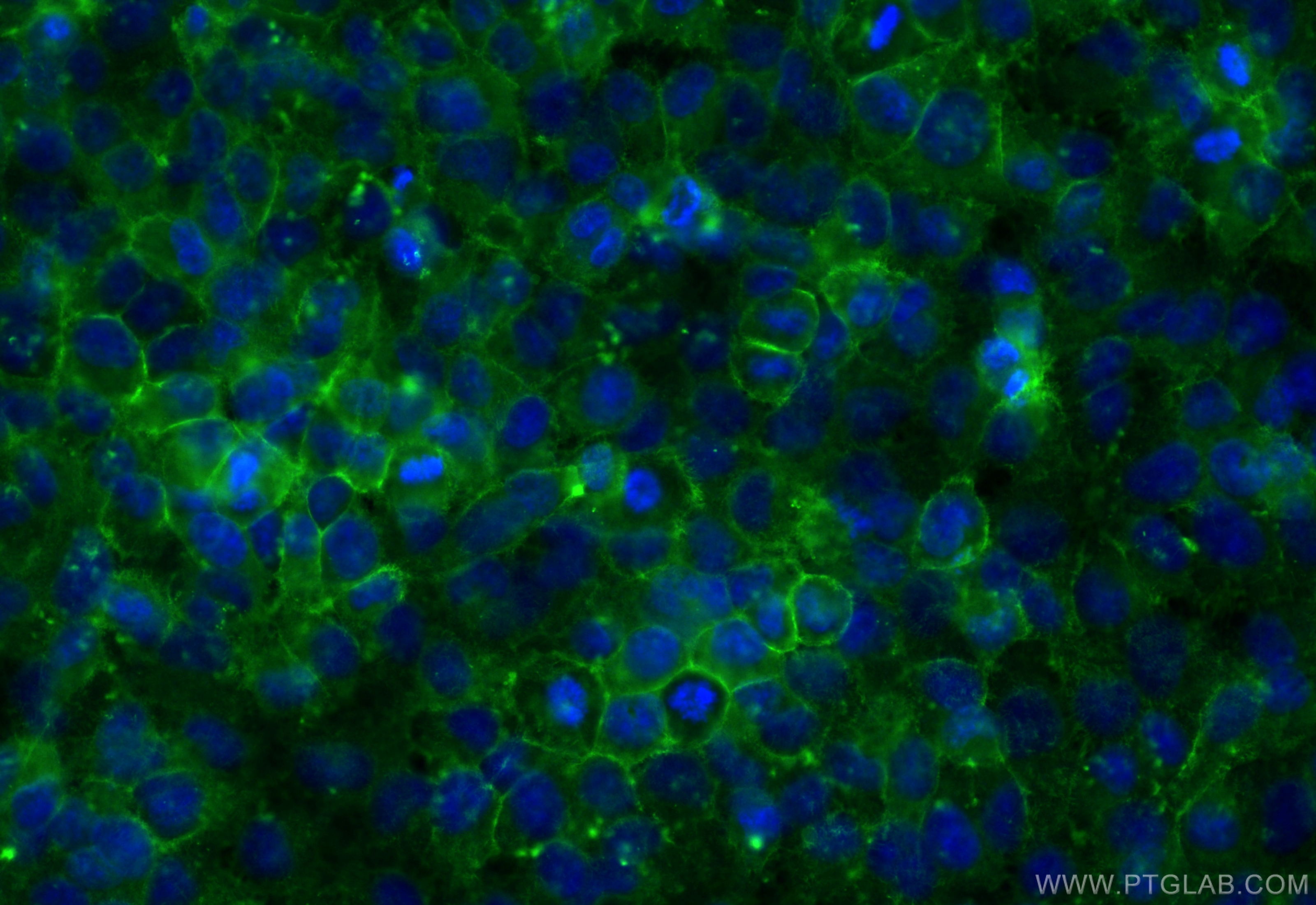 Immunofluorescence (IF) / fluorescent staining of HeLa cells using CoraLite® Plus 488-conjugated Ezrin Polyclonal ant (CL488-26056)