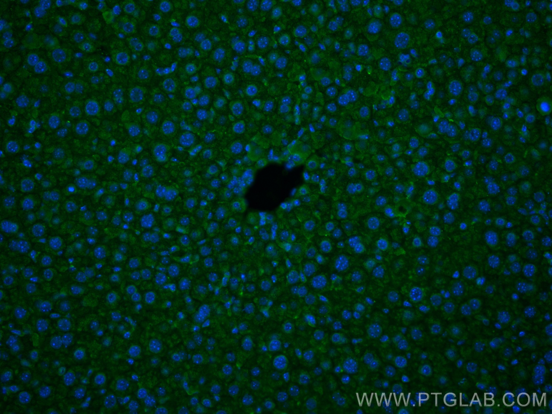 Immunofluorescence (IF) / fluorescent staining of mouse liver tissue using Factor XII Monoclonal antibody (66089-1-Ig)