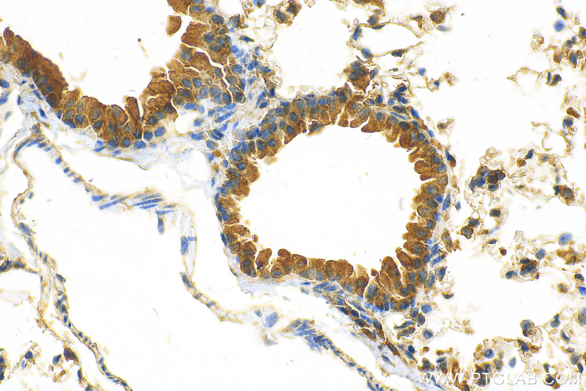 Immunohistochemistry (IHC) staining of mouse lung tissue using F2RL3 Polyclonal antibody (25306-1-AP)