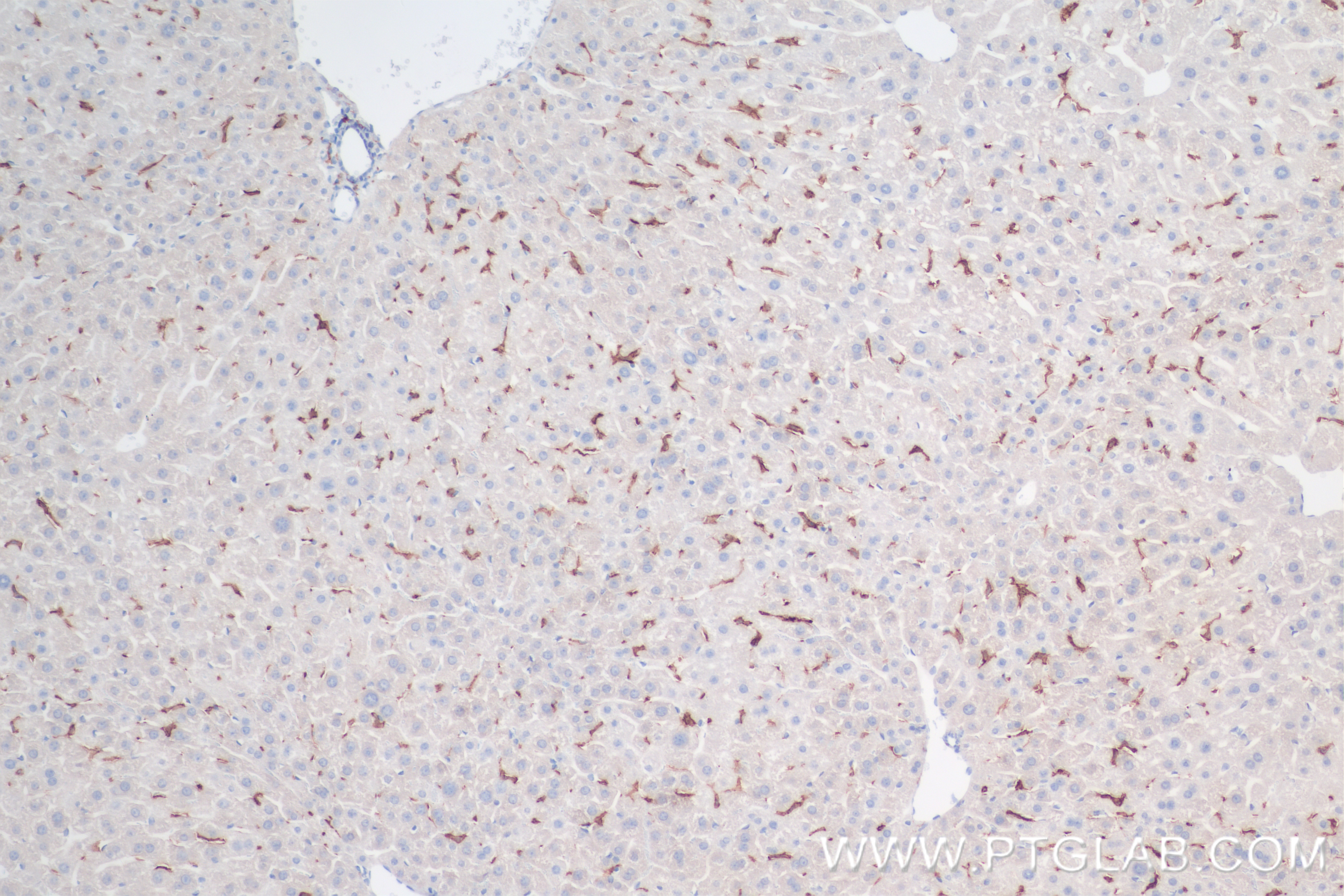 Immunohistochemistry (IHC) staining of mouse liver tissue using F4/80 Recombinant antibody (81668-1-RR)