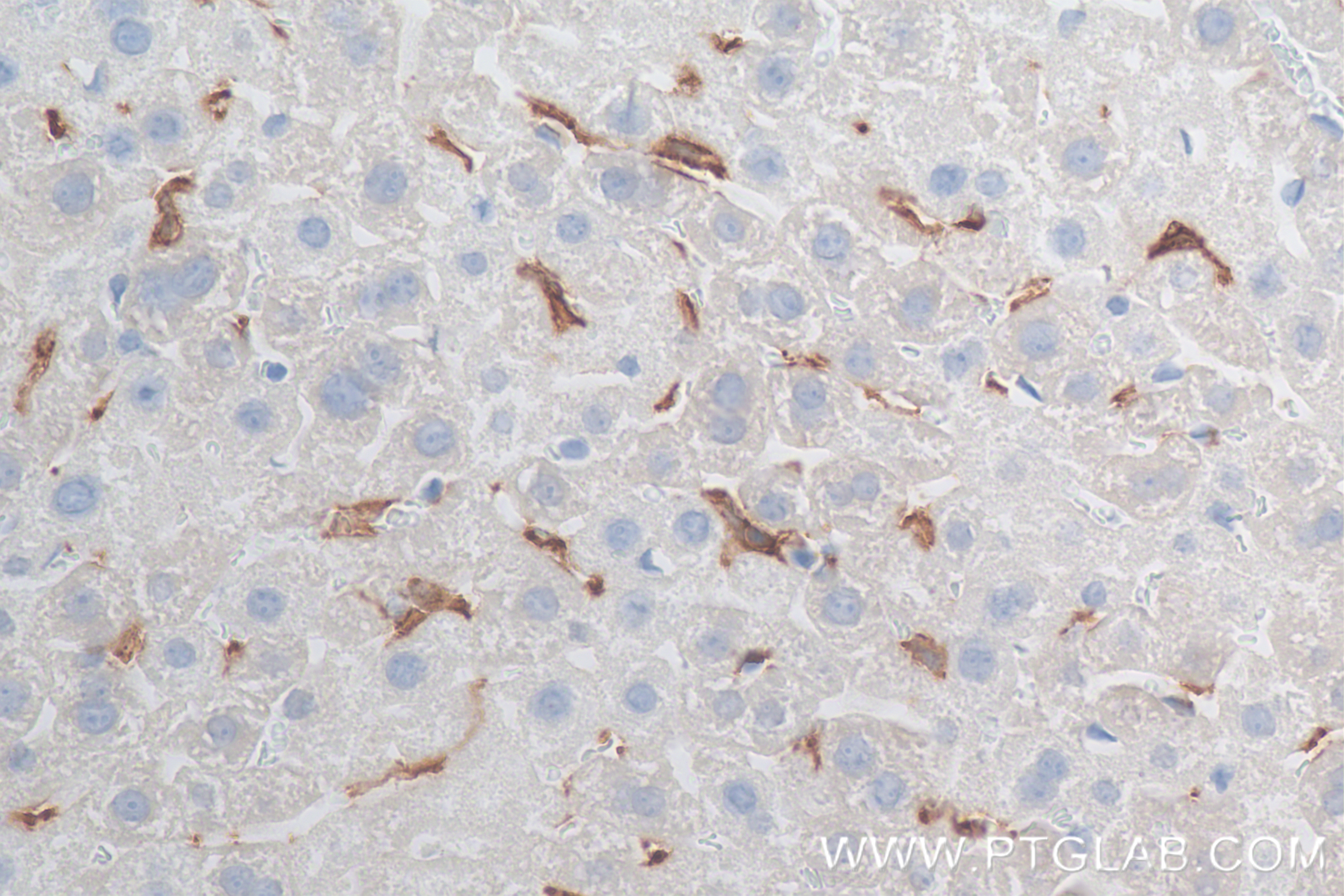 Immunohistochemistry (IHC) staining of mouse liver tissue using F4/80 Recombinant antibody (81668-1-RR)