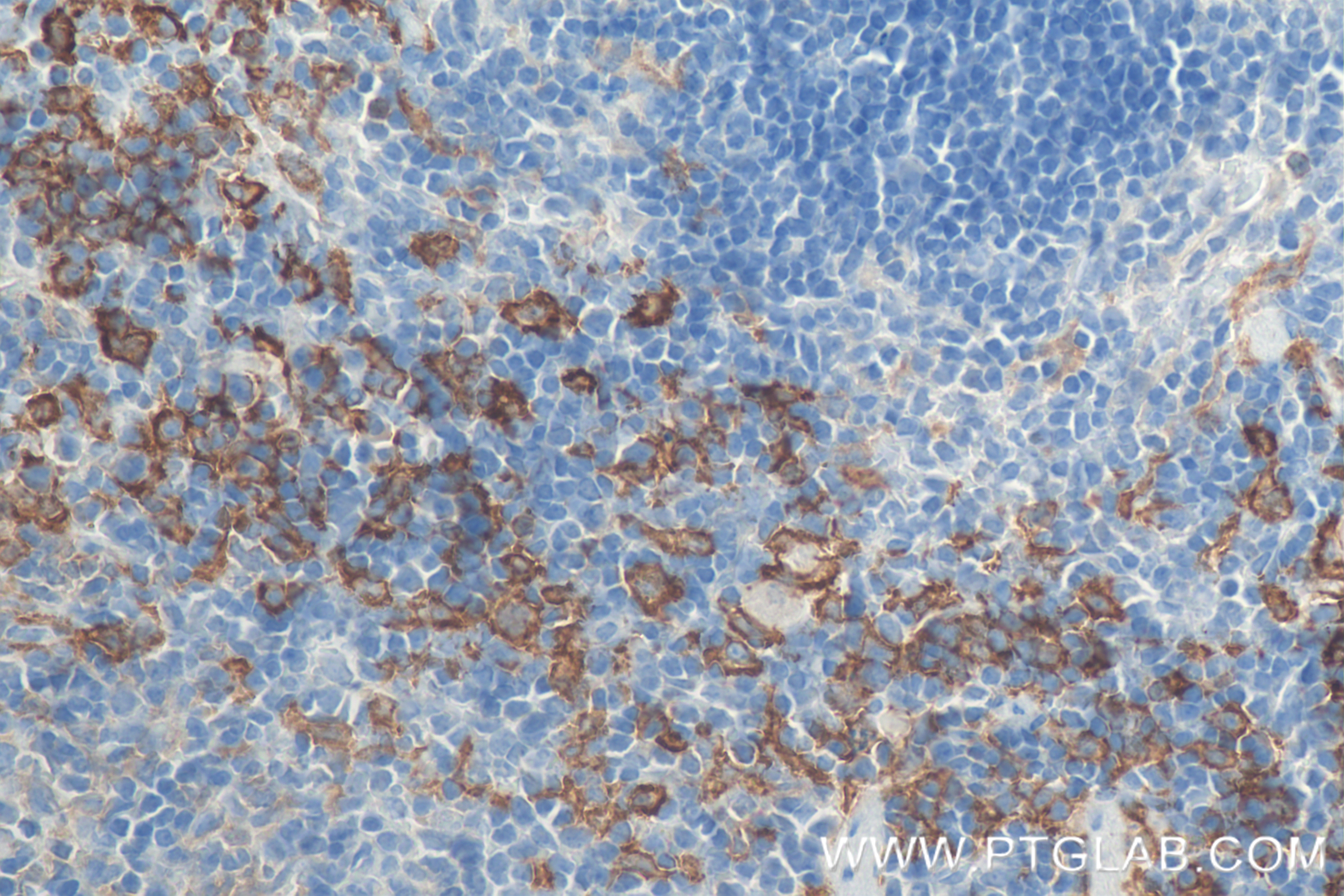 Immunohistochemistry (IHC) staining of mouse spleen tissue using F4/80 Recombinant antibody (81668-1-RR)