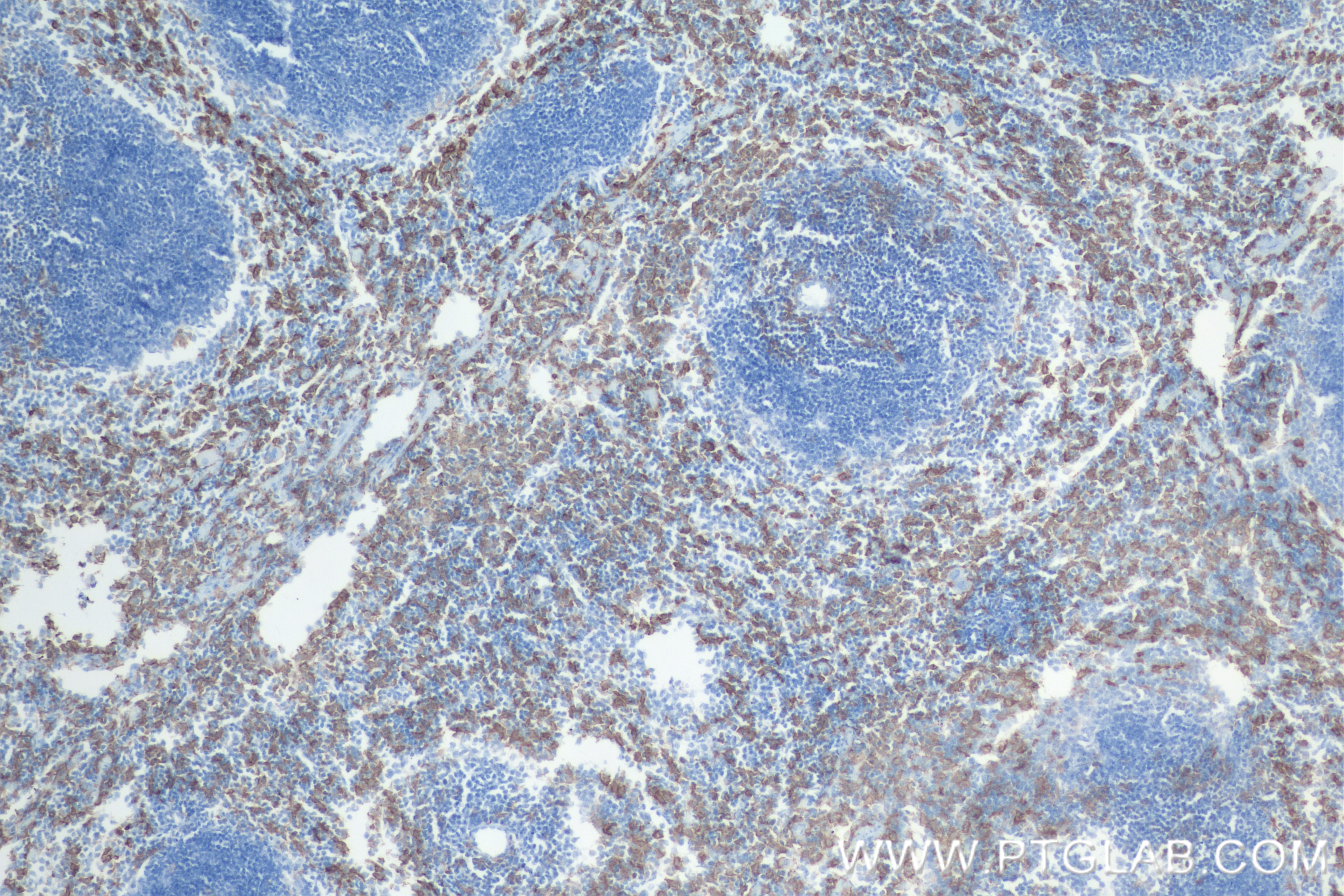 Immunohistochemistry (IHC) staining of mouse spleen tissue using F4/80 Recombinant antibody (84538-1-RR)