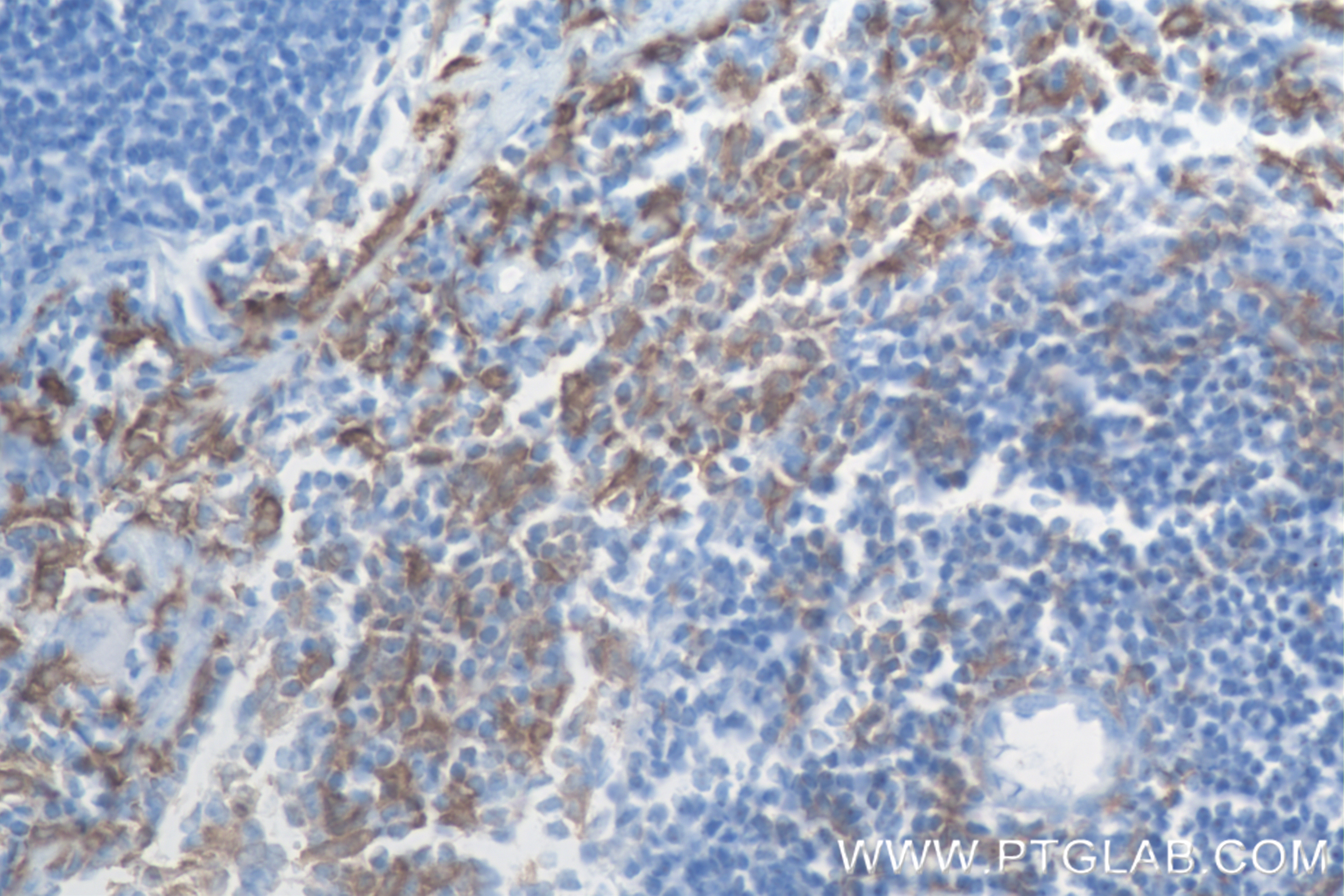 Immunohistochemistry (IHC) staining of mouse spleen tissue using F4/80 Recombinant antibody (84538-1-RR)