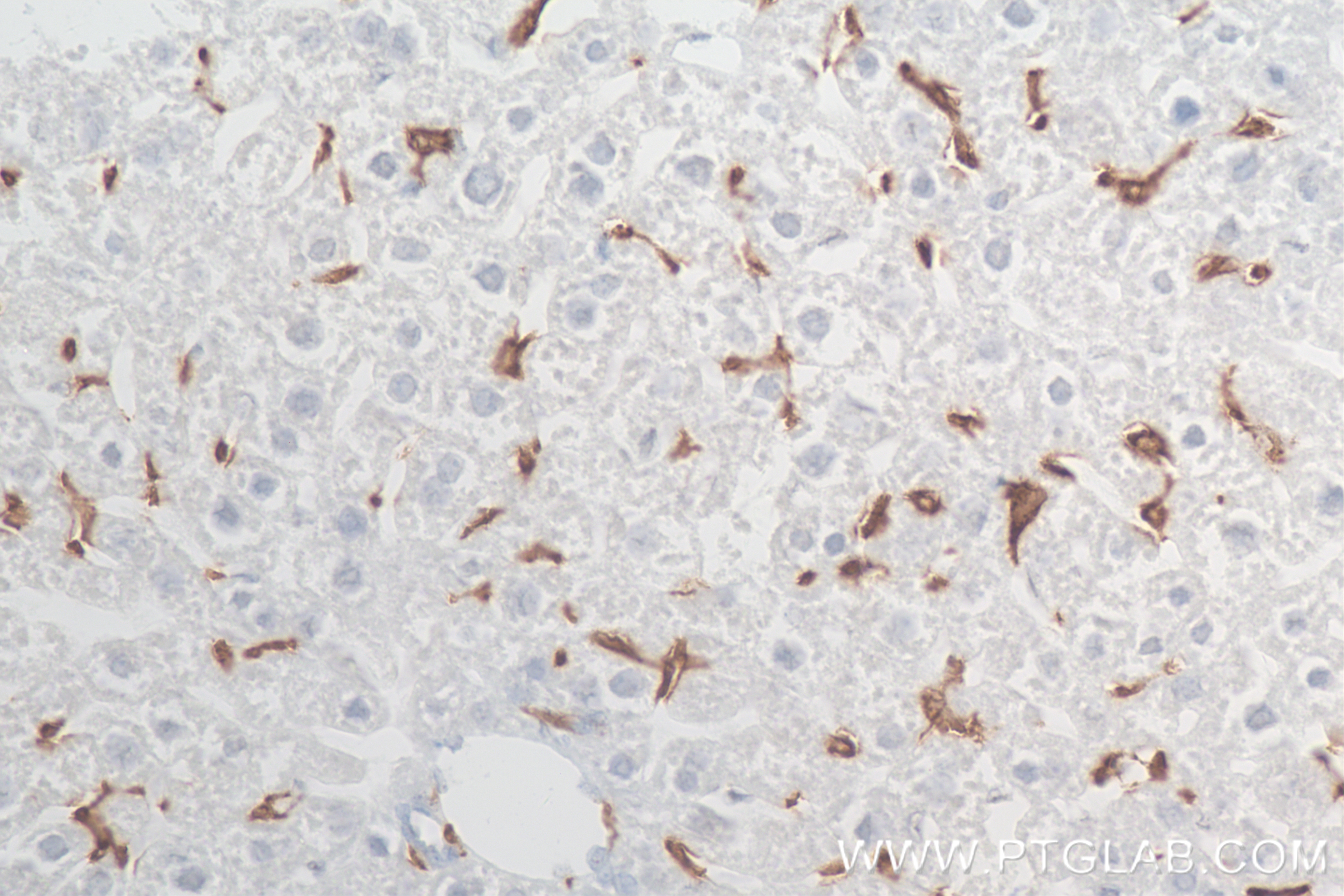 Immunohistochemistry (IHC) staining of mouse liver tissue using F4/80 Recombinant antibody (84538-1-RR)