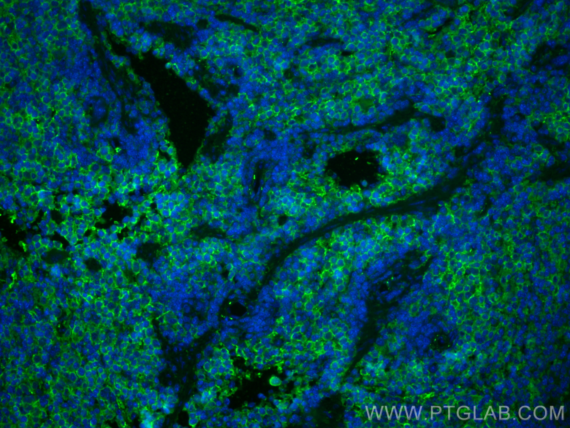 Immunofluorescence (IF) / fluorescent staining of mouse spleen tissue using CoraLite® Plus 488-conjugated F4/80 Polyclonal ant (CL488-28463)