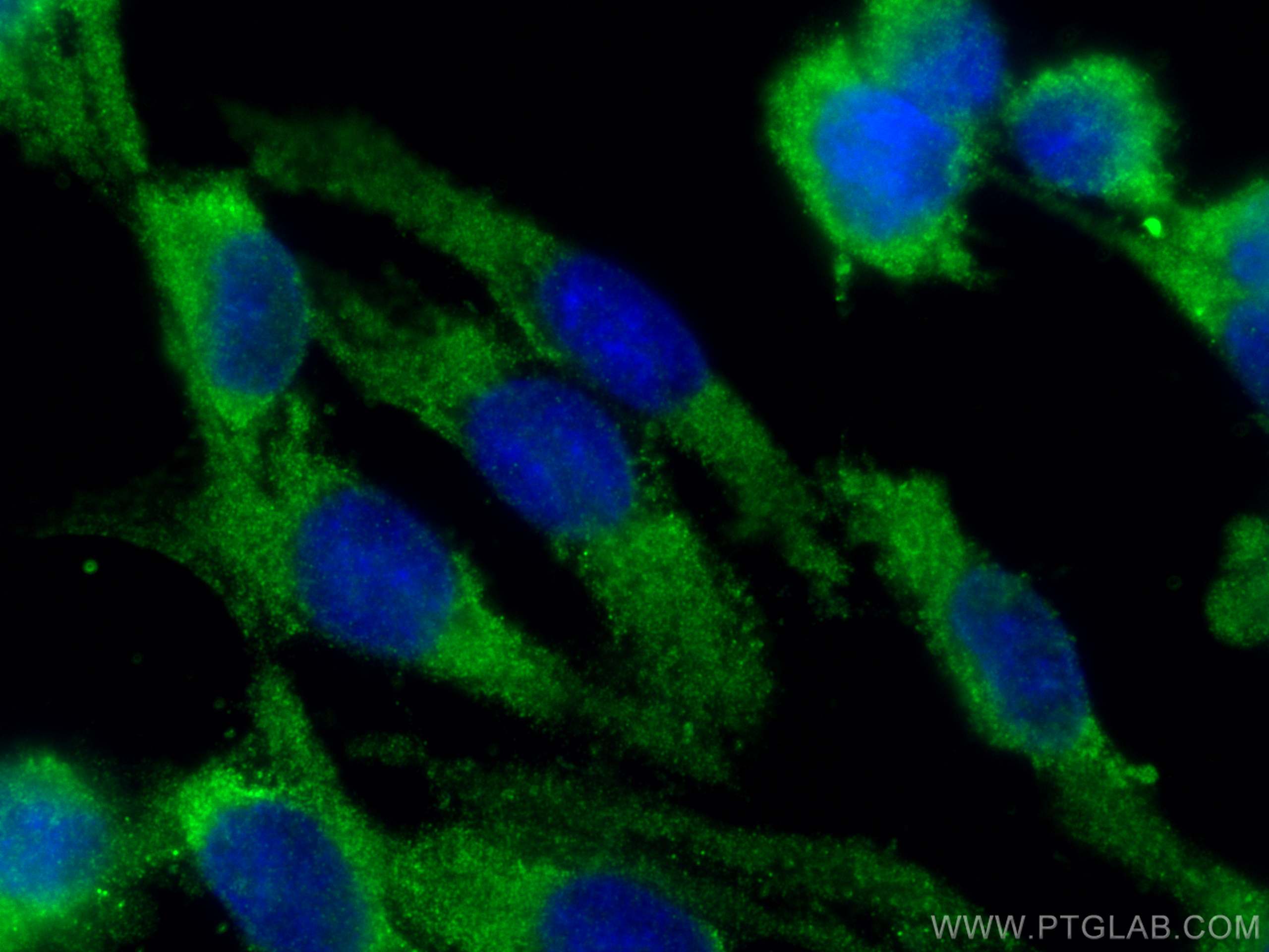 Immunofluorescence (IF) / fluorescent staining of HUVEC cells using F7 Polyclonal antibody (23058-1-AP)