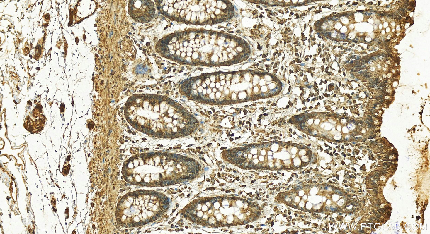 Immunohistochemistry (IHC) staining of human colon tissue using FABP4 Polyclonal antibody (15872-1-AP)