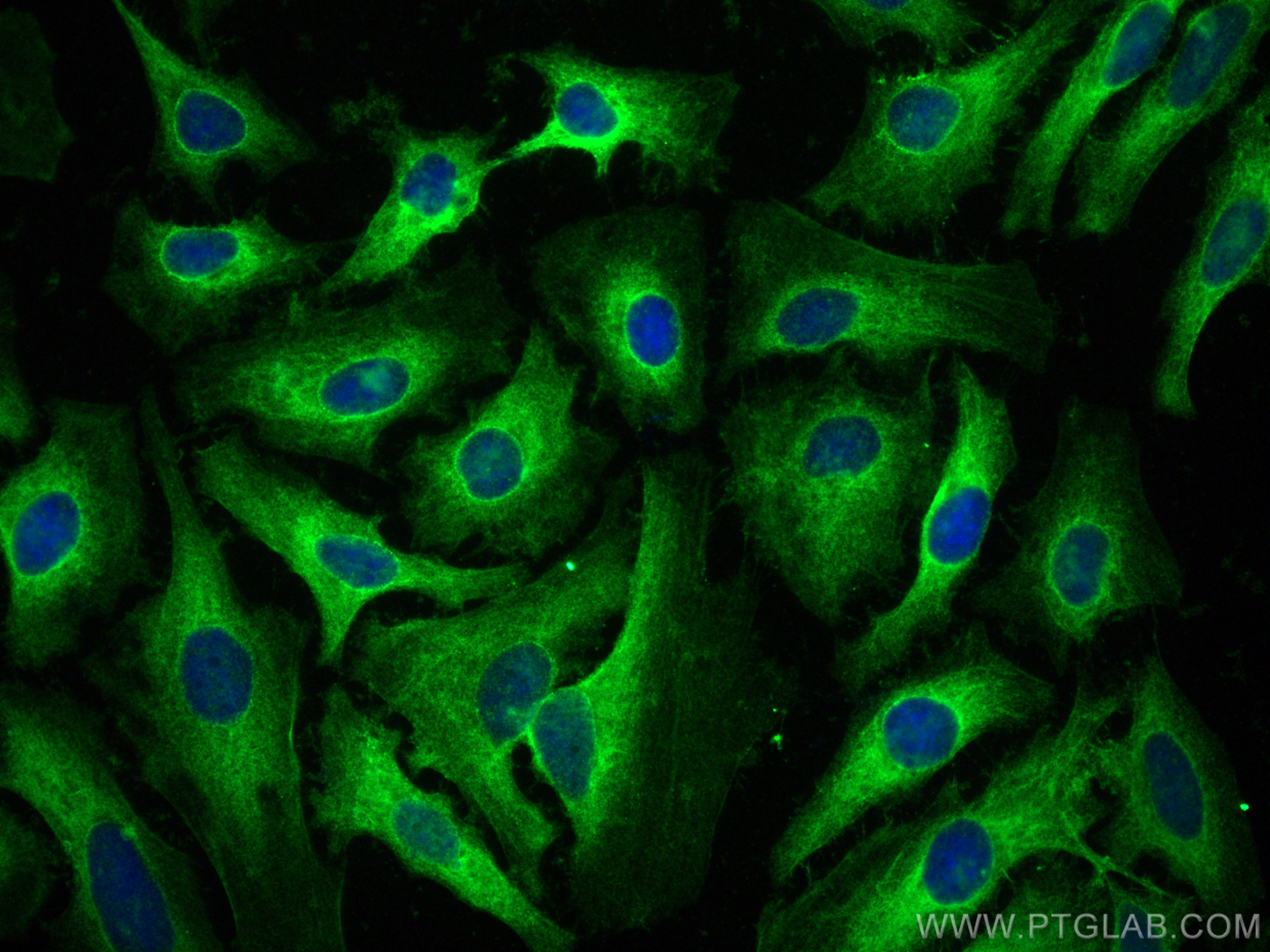 Immunofluorescence (IF) / fluorescent staining of HeLa cells using FABP5 Polyclonal antibody (12348-1-AP)