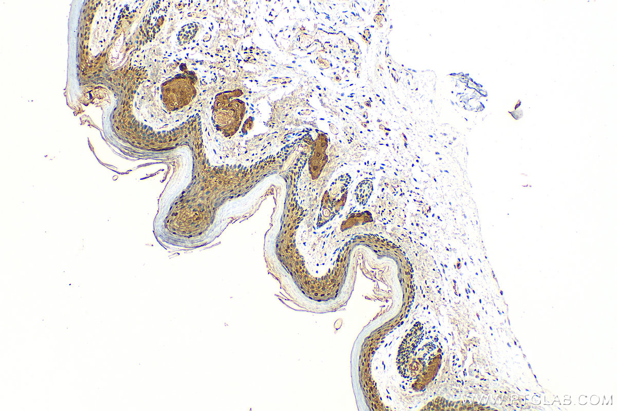 Immunohistochemistry (IHC) staining of mouse skin tissue using FABP5 Polyclonal antibody (12348-1-AP)