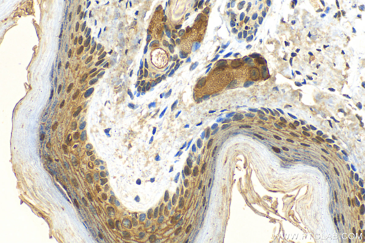 Immunohistochemistry (IHC) staining of mouse skin tissue using FABP5 Polyclonal antibody (12348-1-AP)