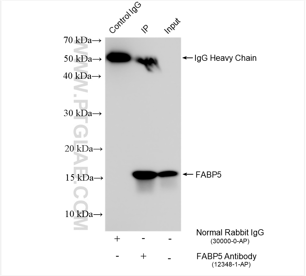 Immunoprecipitation (IP) experiment of A375 cells using FABP5 Polyclonal antibody (12348-1-AP)