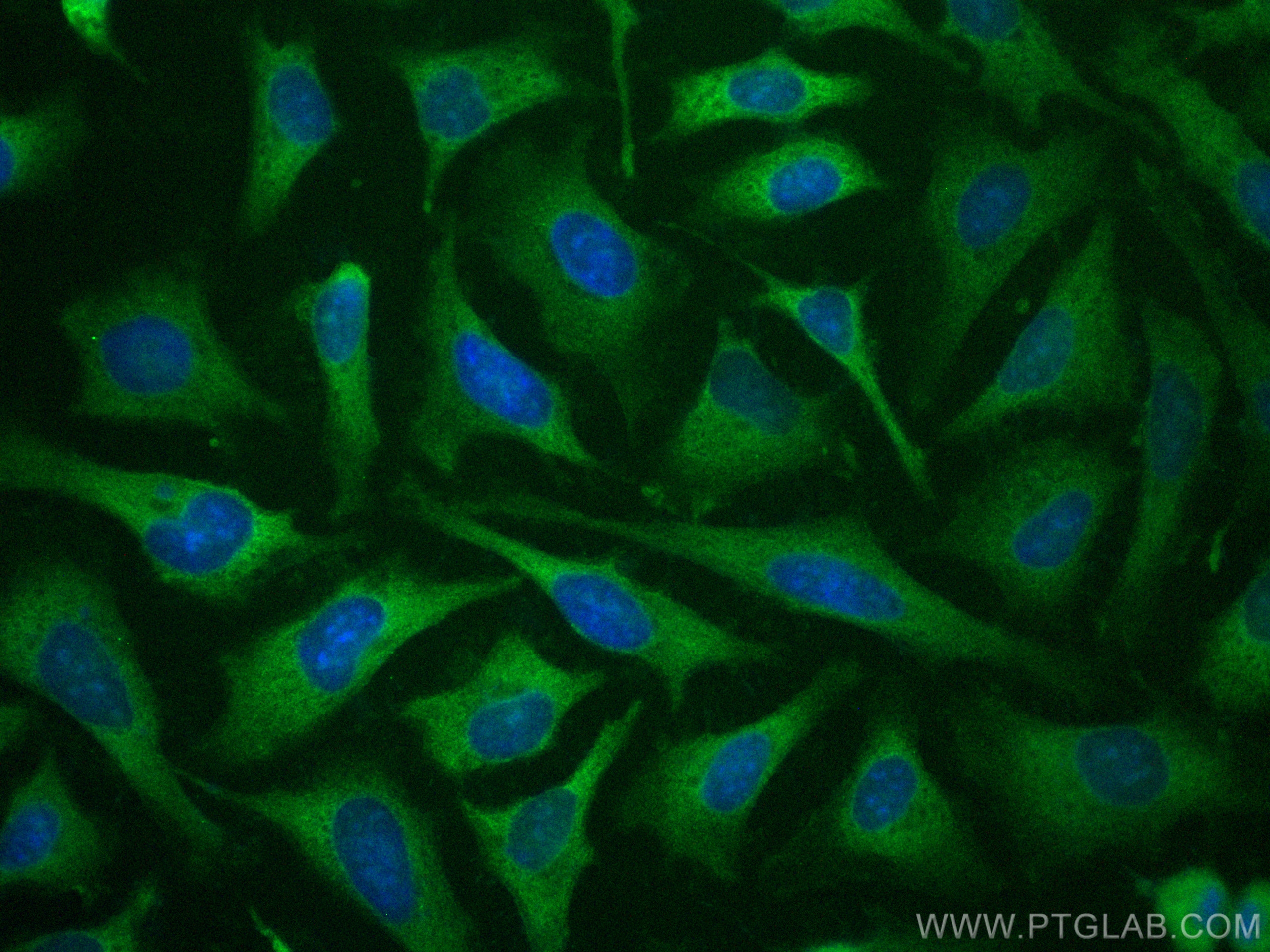 Immunofluorescence (IF) / fluorescent staining of HeLa cells using CoraLite® Plus 488-conjugated FABP5 Polyclonal ant (CL488-12348)