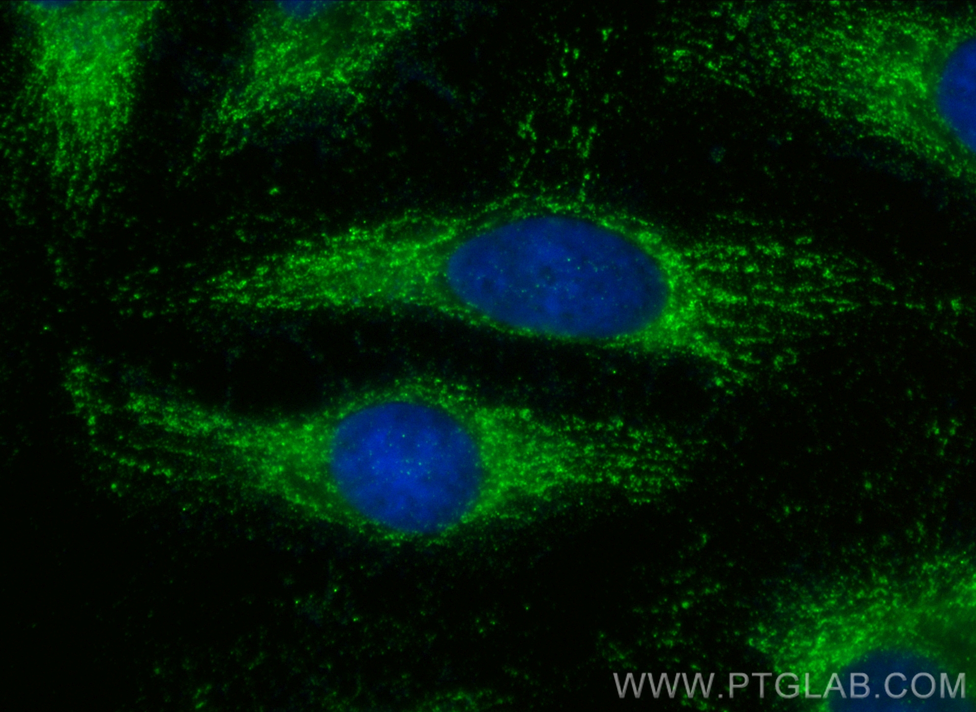 Immunofluorescence (IF) / fluorescent staining of HeLa cells using FADS1 Polyclonal antibody (10627-1-AP)