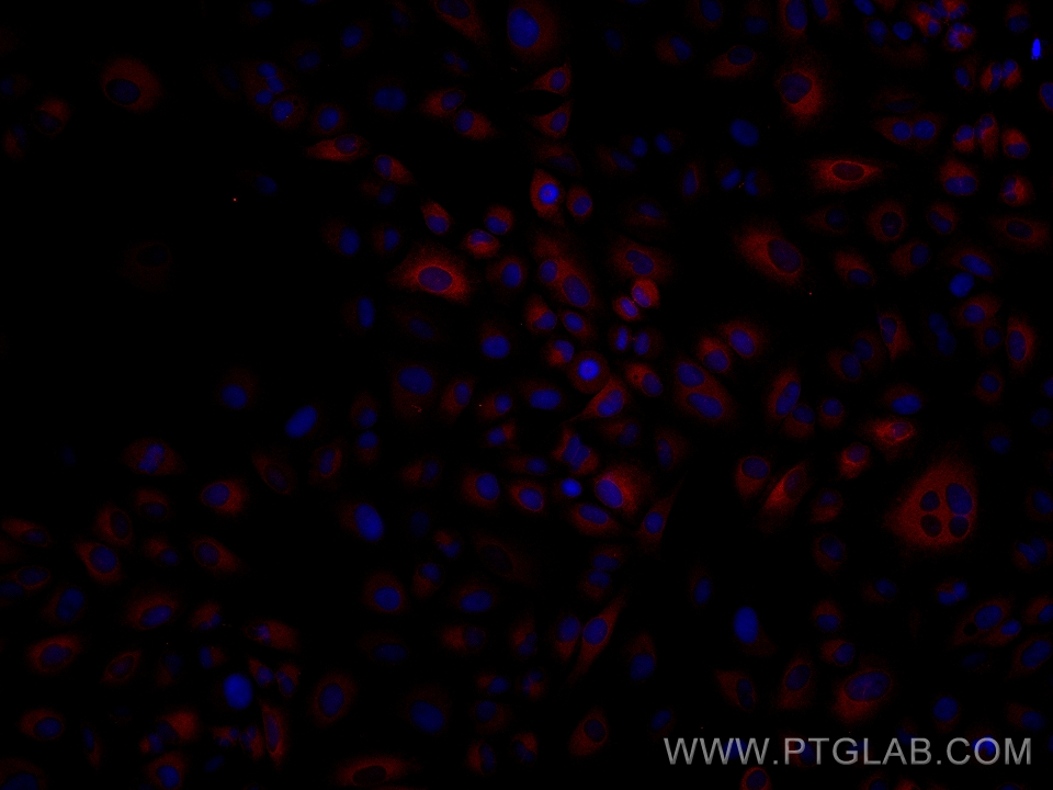 Immunofluorescence (IF) / fluorescent staining of A549 cells using FADS2 Monoclonal antibody (68026-1-Ig)