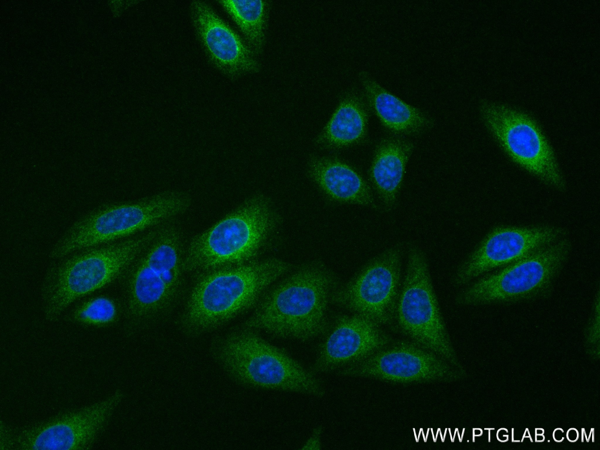 Immunofluorescence (IF) / fluorescent staining of HepG2 cells using FADS2-Specific Recombinant antibody (84527-5-RR)