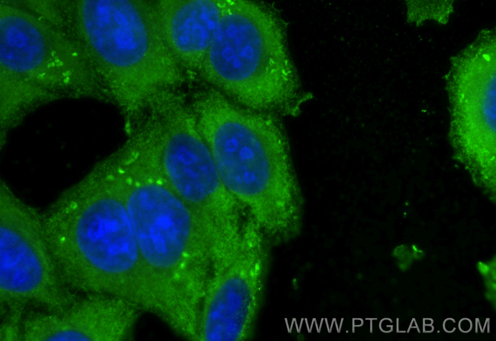 Immunofluorescence (IF) / fluorescent staining of HepG2 cells using FAH Monoclonal antibody (67986-1-Ig)