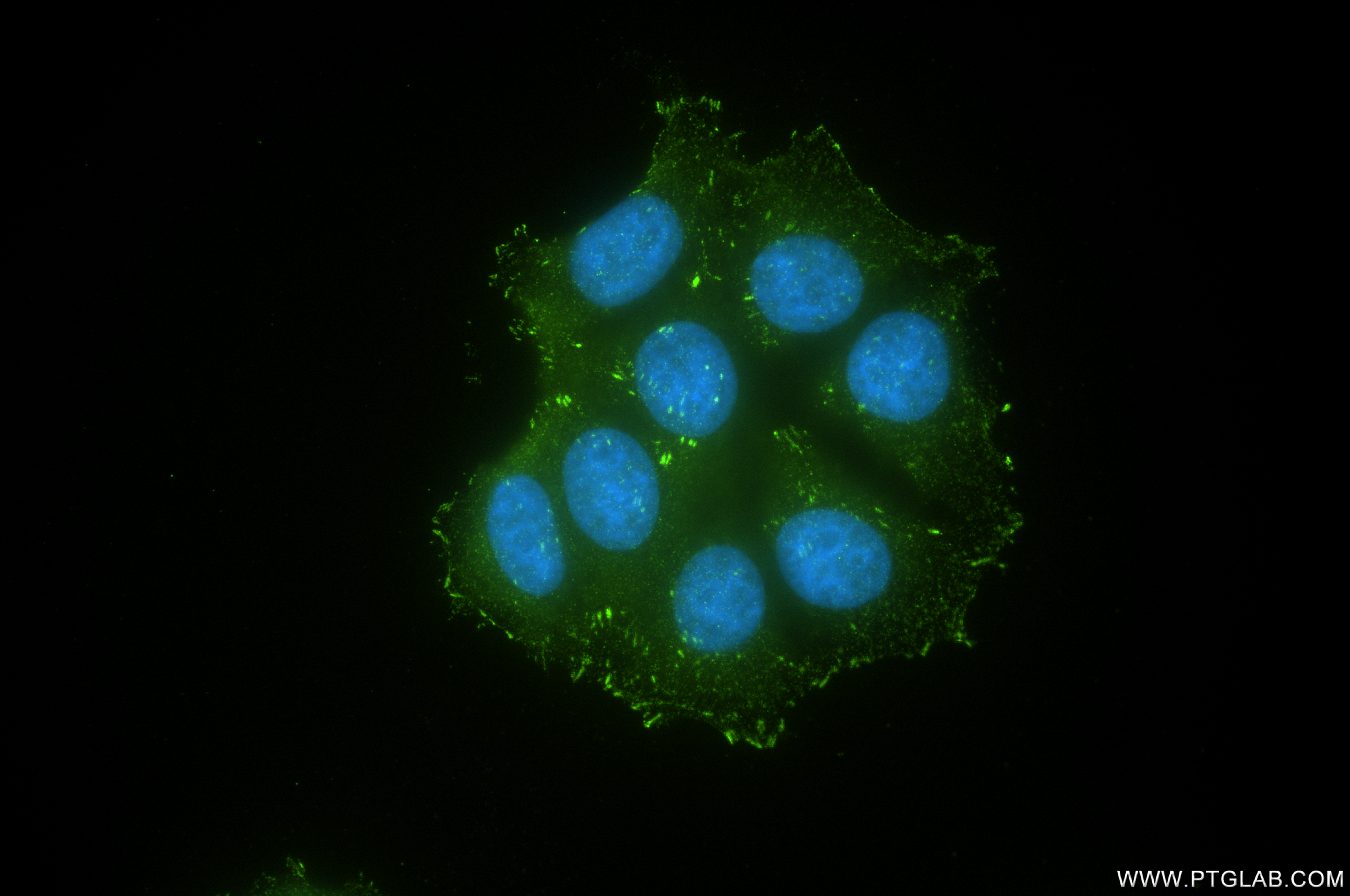 Immunofluorescence (IF) / fluorescent staining of MCF-7 cells using FAK Recombinant antibody (81334-5-RR)