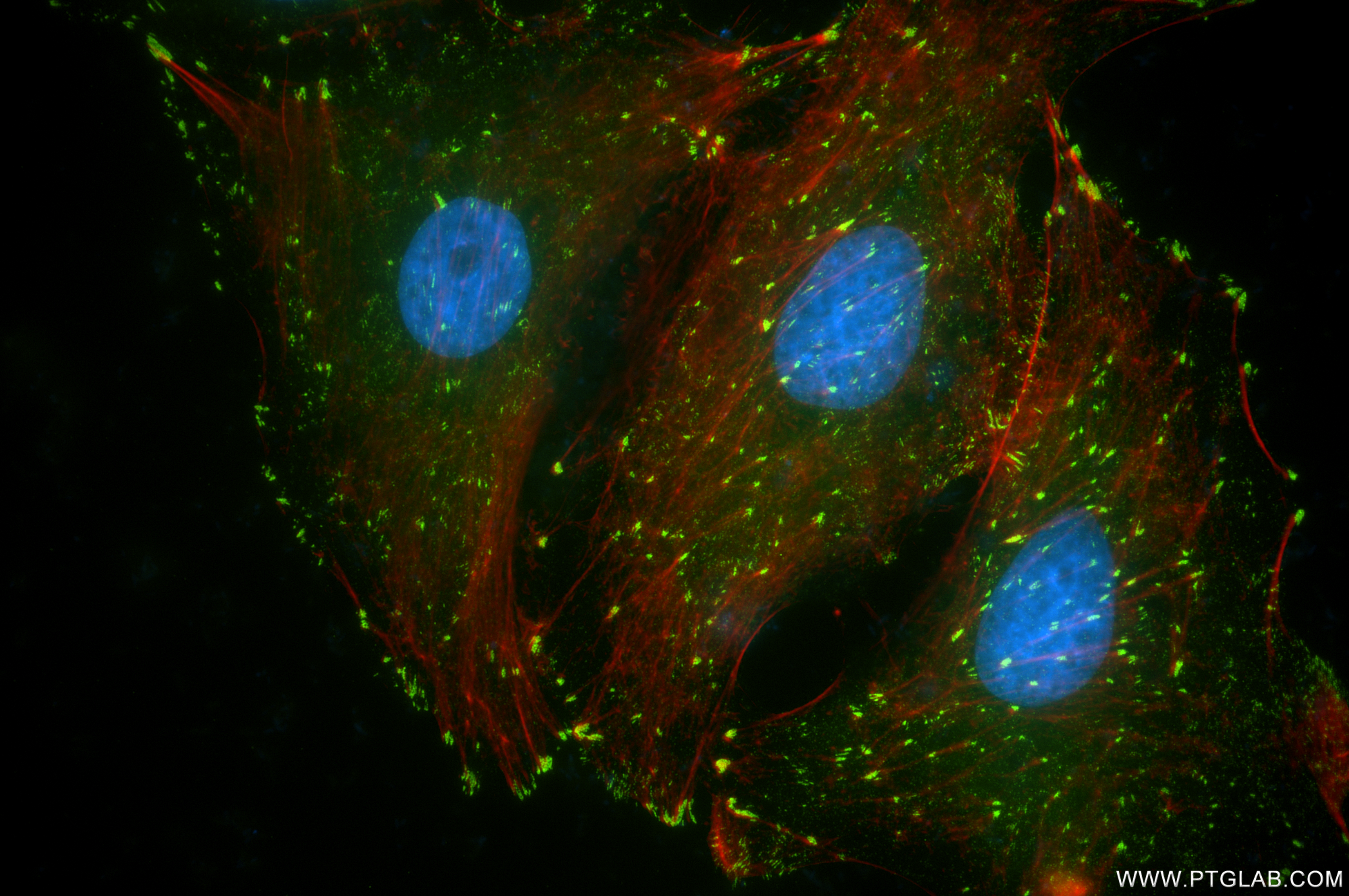 Immunofluorescence (IF) / fluorescent staining of A549 cells using FAK Recombinant antibody (81334-5-RR)