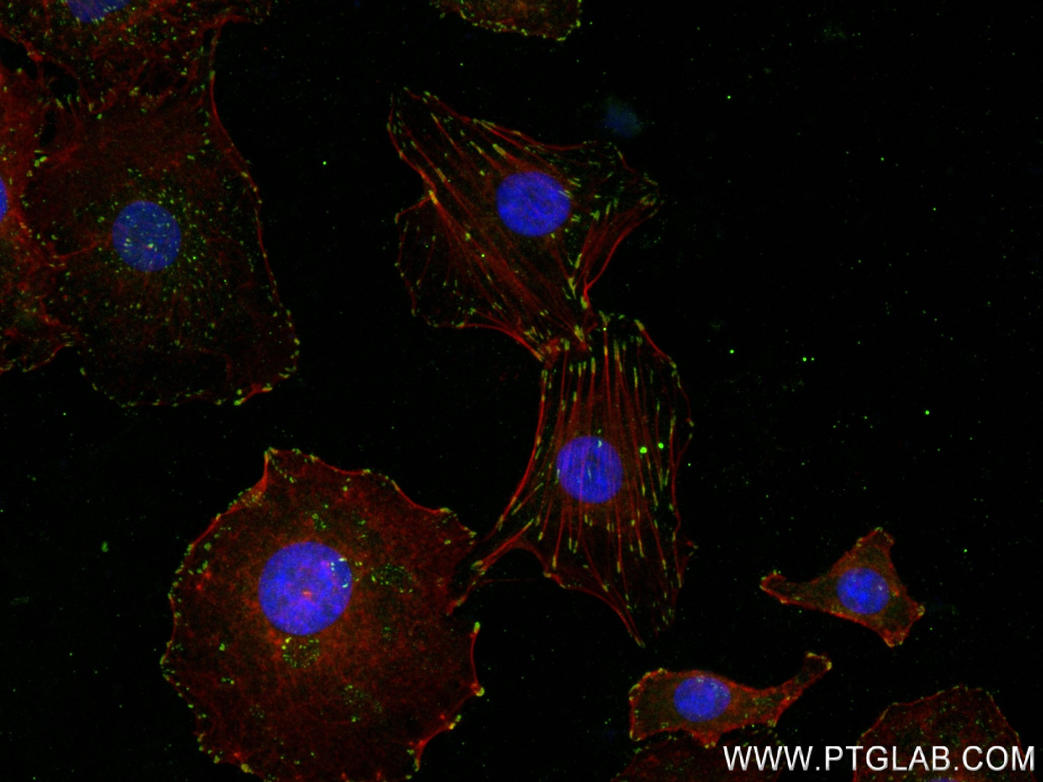 Immunofluorescence (IF) / fluorescent staining of A549 cells using Phospho-FAK (Tyr397) Recombinant antibody (83933-1-RR)