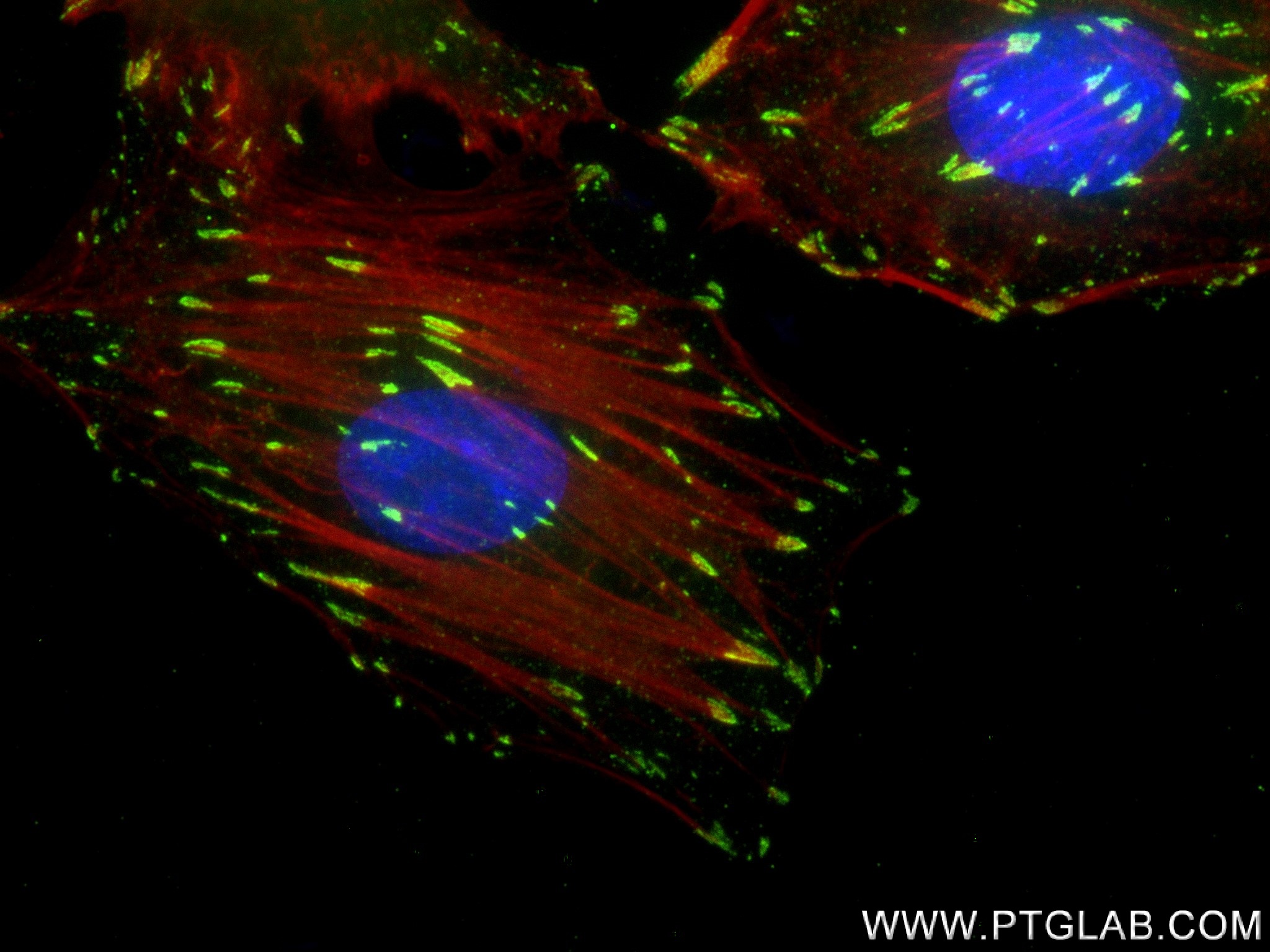 Immunofluorescence (IF) / fluorescent staining of A549 cells using Phospho-FAK (Tyr397) Recombinant antibody (83933-1-RR)