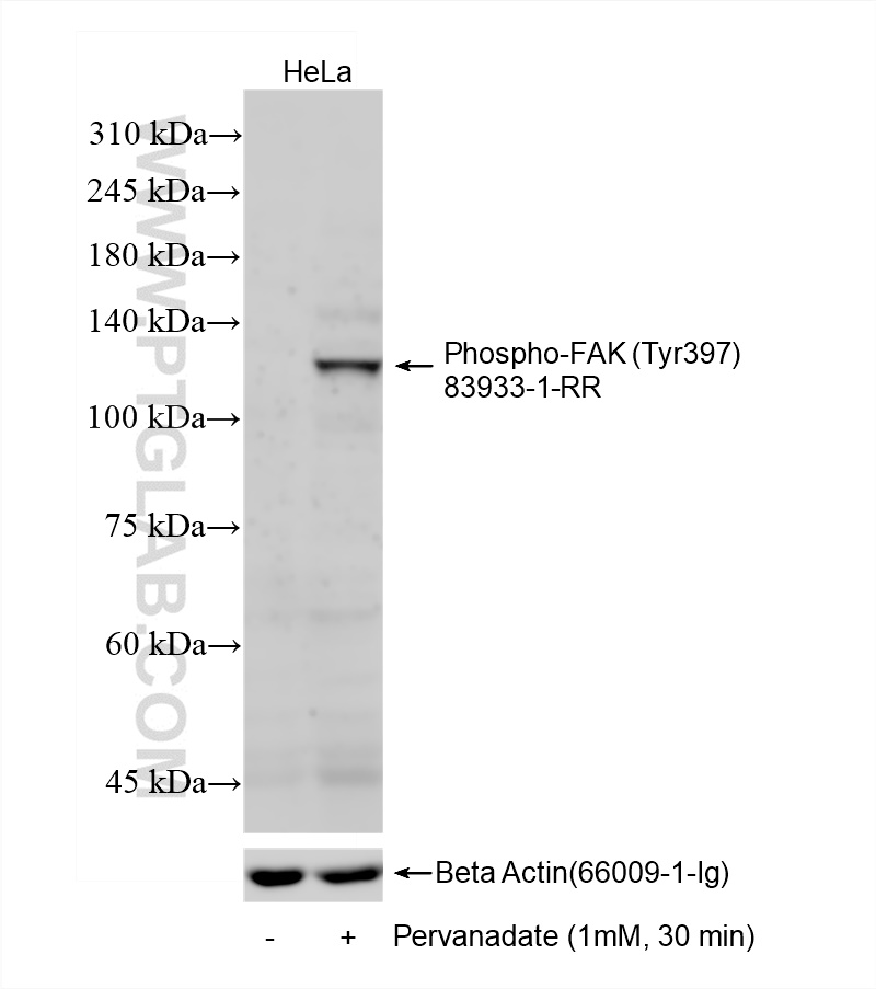 Western Blot (WB) analysis of various lysates using Phospho-FAK (Tyr397) Recombinant antibody (83933-1-RR)