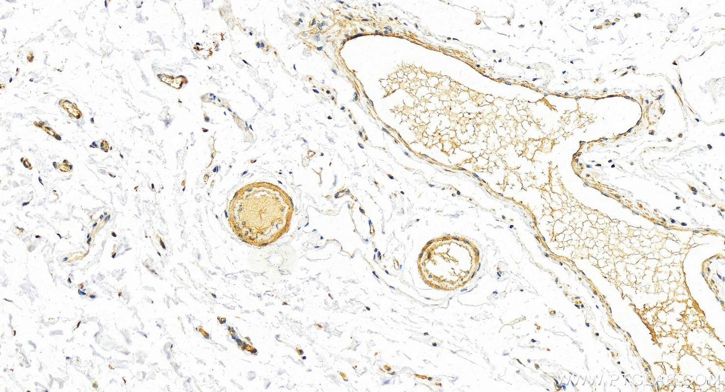 Immunohistochemistry (IHC) staining of human colon tissue using ABHD17A Polyclonal antibody (15854-1-AP)