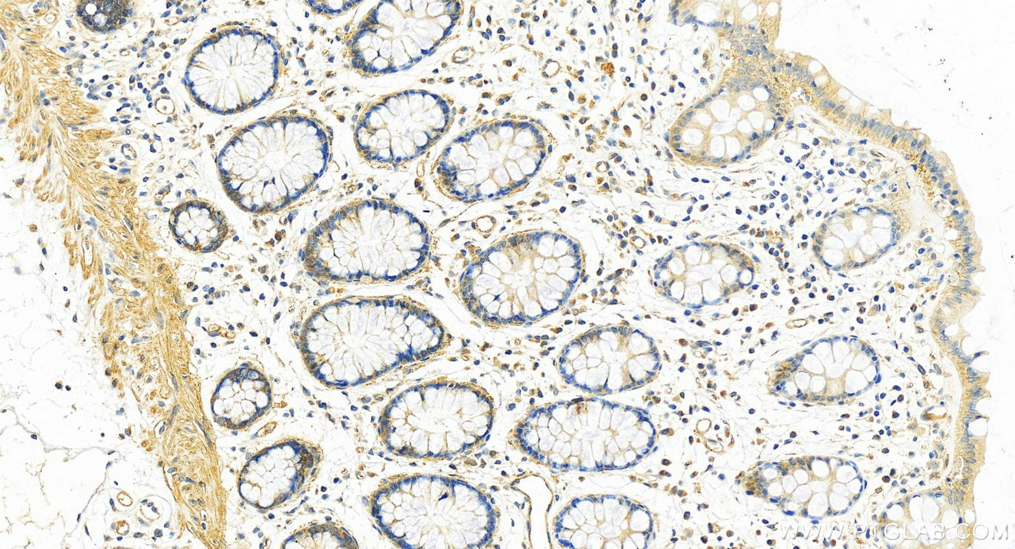 Immunohistochemistry (IHC) staining of human colon tissue using ABHD17A Polyclonal antibody (15854-1-AP)