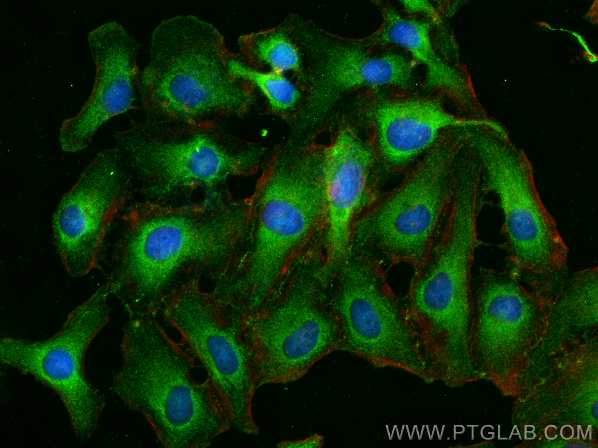 Immunofluorescence (IF) / fluorescent staining of HeLa cells using FAM119A Polyclonal antibody (21079-1-AP)