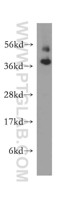 Western Blot (WB) analysis of human brain tissue using FAM127A Polyclonal antibody (10307-1-AP)