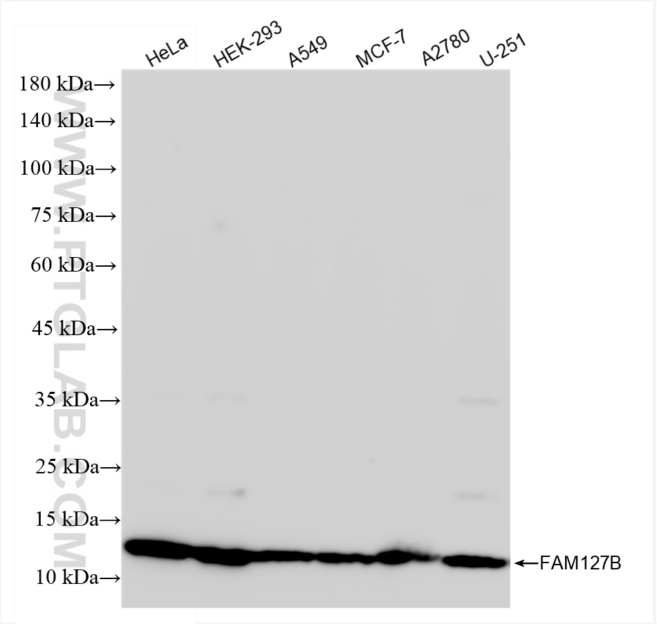 Western Blot (WB) analysis of various lysates using FAM127B Recombinant antibody (83862-1-RR)