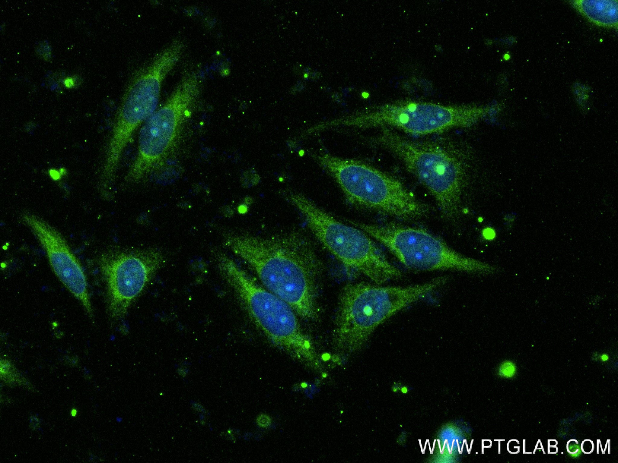 Immunofluorescence (IF) / fluorescent staining of HepG2 cells using FAM127B Recombinant antibody (83862-2-RR)